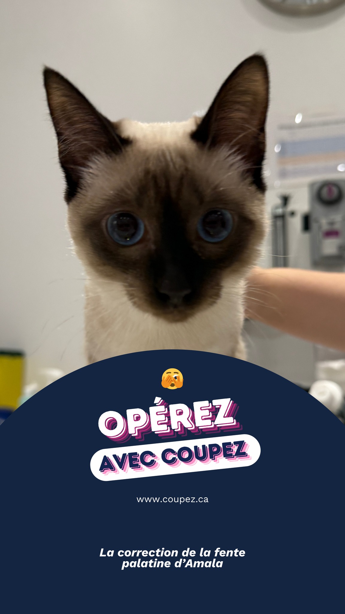 La fente palatine est une malformation congénitale du palais, fréquemment observée chez les très jeunes animaux. Elle crée une communication anormale entre la bouche et le nez, ce qui peut entraîner des écoulements nasaux, des difficultés à s’alimenter et un risque accru de pneumonie par aspiration.
Nous avons récemment effectué la correction de la fente palatine d’Amala, une adorable siamoise de 7 mois qui présentait cette anomalie. La chirurgie s’est très bien déroulée, et Amala peut maintenant manger normalement et respirer plus confortablement. 😸
On remercie ses propriétaires, ainsi que la Clinique vétérinaire de Fontainebleau pour leur accueil!
