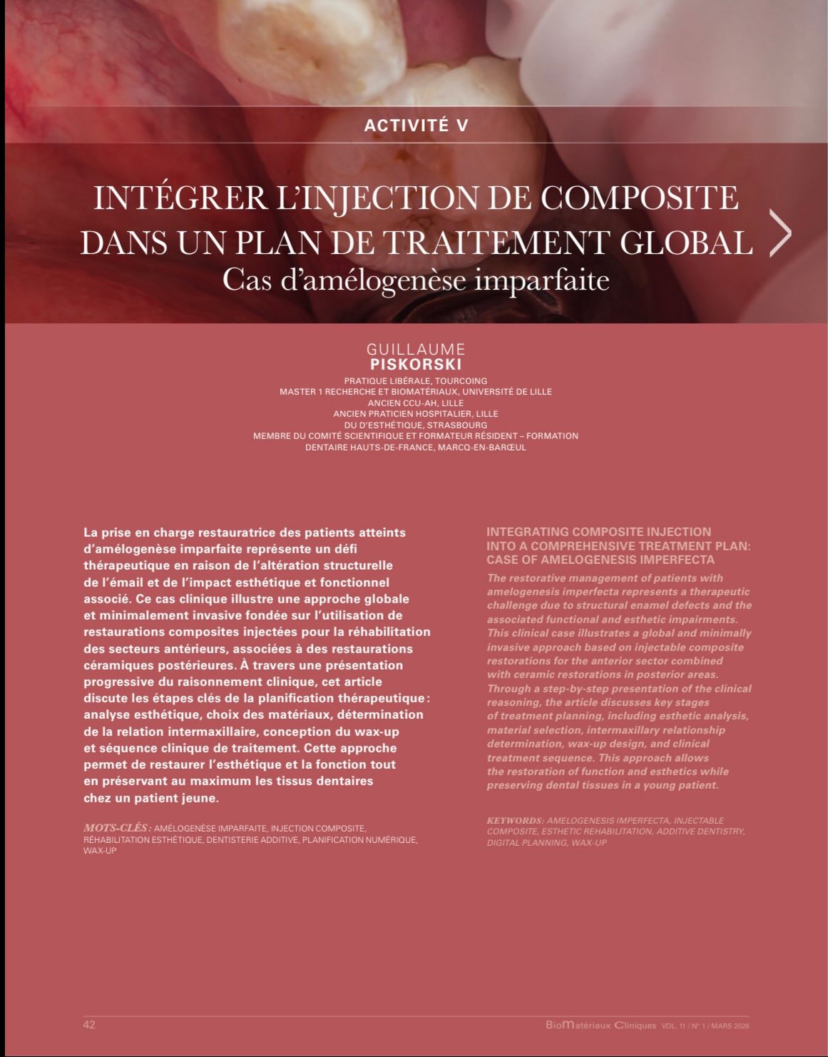 Injection & amelogenesis imperfecta
Ref : BMC Vol 11 n1 : mars 2026
Thx to @guillaume_sabathier for ceramic restorations on this case .
Thx to @attaljeanpierre for his help
Thx to @smilecloud_biometrics for the design