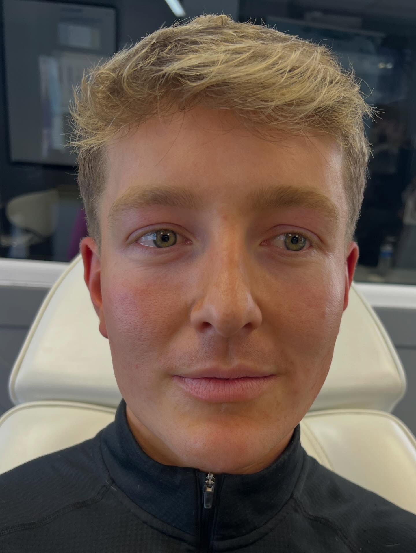 Male face contour 🤍. Enhancing natural structure with precise contouring—subtle definition that elevates and refines facial features. #oxford #oxforduniversity #oxfordsalon #oxfordaesthetics #aestheticsbyam