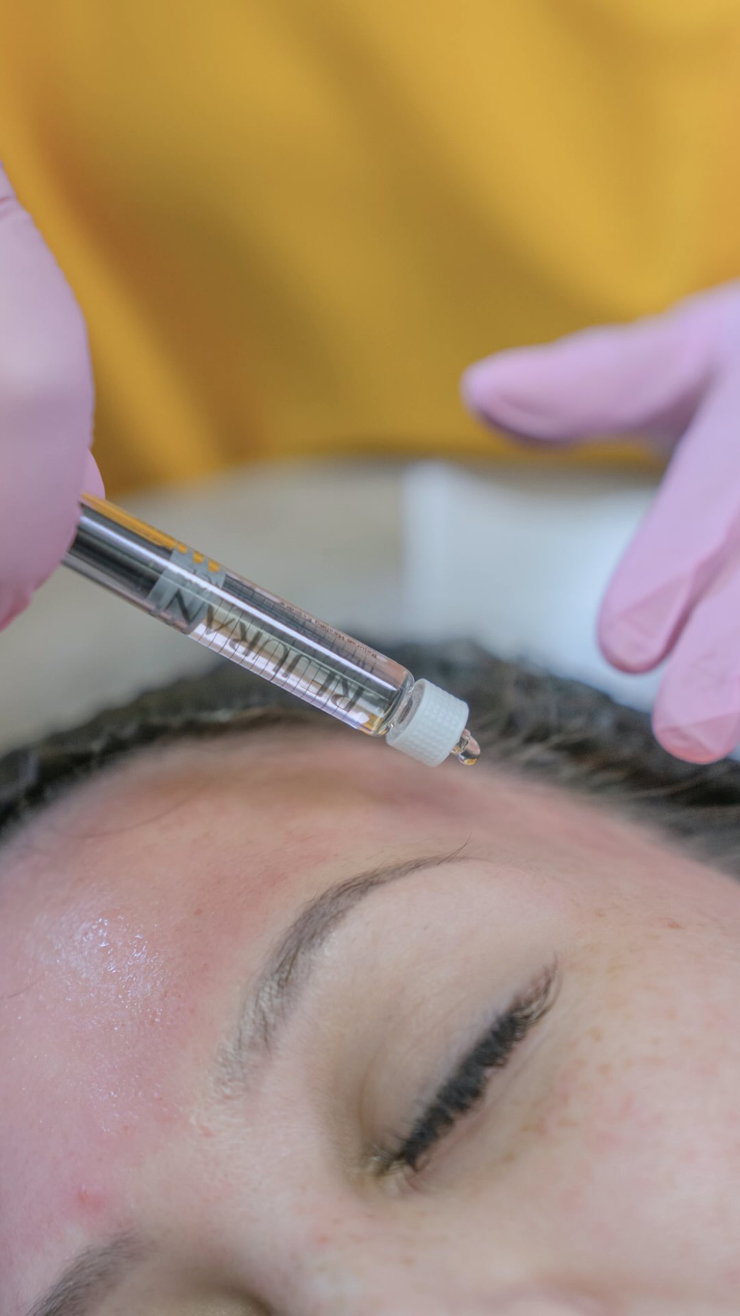 đRosacea isnât just about redness. Itâs chronic inflammation + a compromised skin barrier that keeps the cycle going.
Most treatments focus on calming the surface. But if your barrier is broken, the irritation keeps coming back.
Thatâs where Rejuran Booster comes in.
⨠Polynucleotides (PN) help repair and strengthen the skin barrier from within
⨠Reduces inflammation at the source, not just the surface
⨠Improves skin texture, tone, and resilience over time
⨠Gentle enough for reactive, rosacea-prone skin
This isnât a quick fix. Itâs strategic repair that actually addresses whatâs broken.
We donât just calm rosacea. We rebuild the skin. đż
Comment SKIN to book your consultation and see if Rejuran is right for your skin.
#hawaiinursepractitioner #hawaiiestheticians #hawaiimedspa #medspahonolulu #hawaiiaestheicnurse