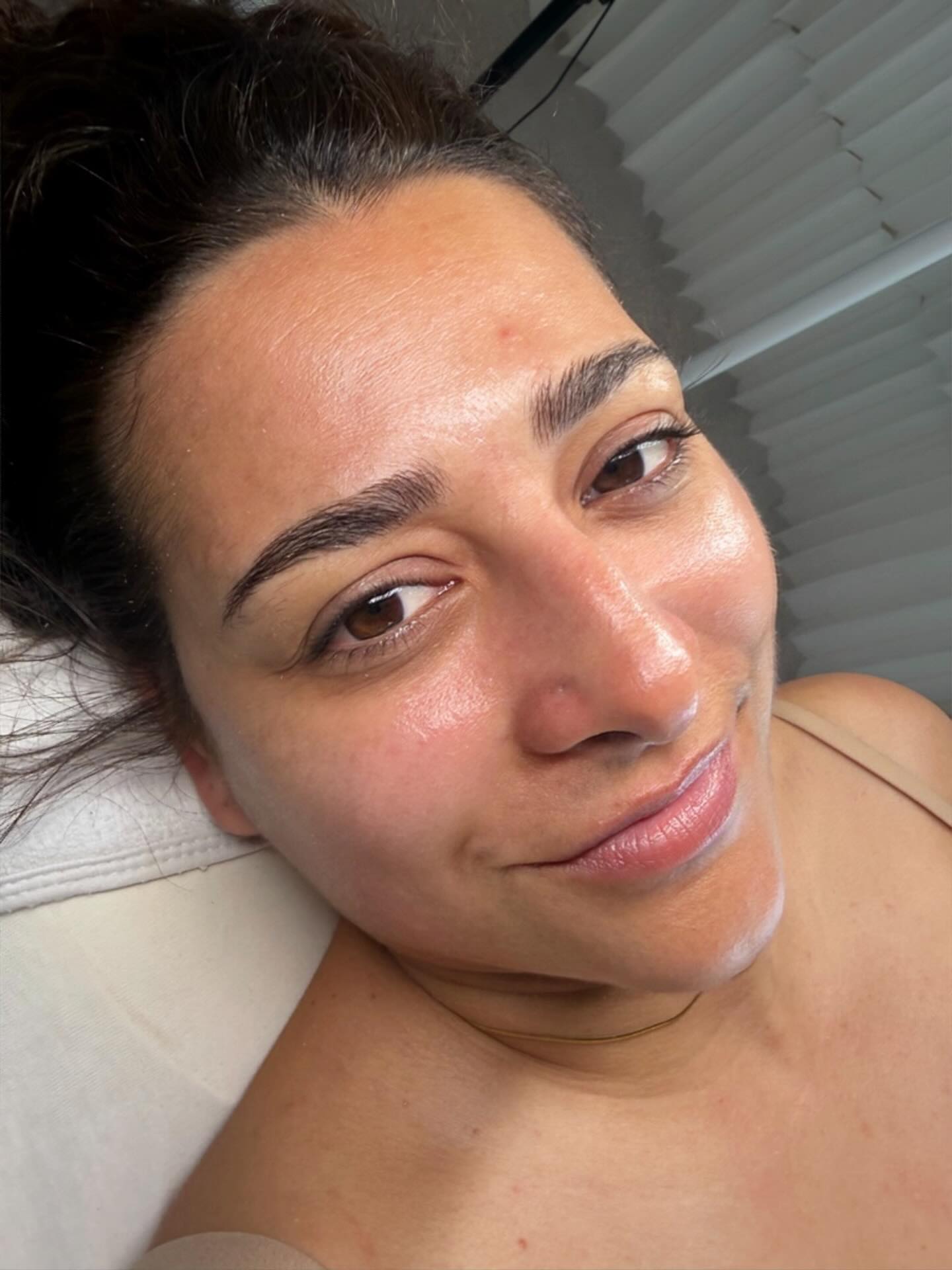 Wenn deine Haut ein Facial braucht, merkt man es sofort💆♀️💆💁♀️💁♂️Die Mikrodermabrasion sorgt ganzjährig für sofortige Frische, indem sie die oberste Hautschicht schonend abträgt und so die natürliche Hautregeneration sowie ein ebenmäßiges, strahlendes Hautbild fördert.
Our Beautiful Arzum ✨
#zürich #beauty #facial #skin #happiness