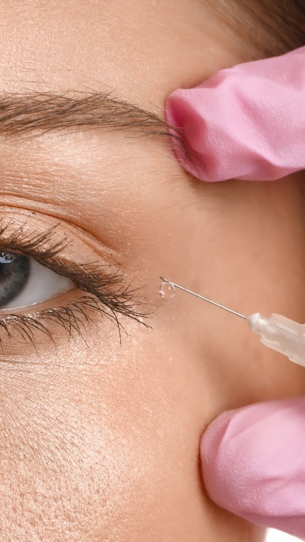 Tear trough filler is designed to soften hollowing and shadowing beneath the eyes for a more rested, refreshed appearance. Because the under eye area is delicate, precision and a strong understanding of anatomy are essential during treatment. That’s why we incorporate ultrasound guidance into our approach for added precision and thoughtful treatment planning.