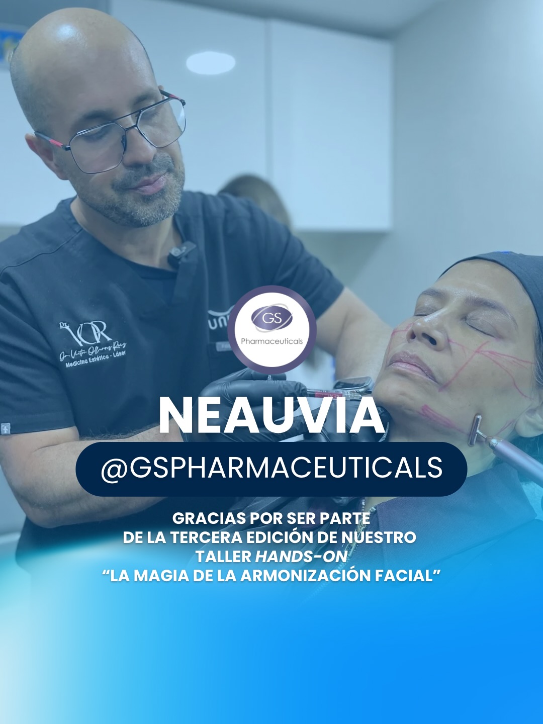 La elección del producto no es un detalle más: es parte esencial del proceso.
Por eso, en nuestro taller hands-on La Magia de la Armonización Facial, trabajamos con Neauvia Intense LV, un relleno dérmico de alta intensidad con 26mg/ml de ácido hialurónico, diseñado específicamente para reposicionar volumen en planos profundos: pómulos, mentón, surcos nasogenianos y contorno mandibular.
Para nuestros participantes en el taller, practicar con un producto de este nivel es entrenar el ojo y la mano con la herramienta correcta.
Ellos aprenden a leer donde colapsó la estructura, a elegir el plano de inyección adecuado y a confiar en un material cuyo perfil de seguridad y comportamiento clínico está respaldado por evidencia.
En IBIDIL, celebramos tener a @gspharmaceuticals como aliados. 🤝 ¡Que sean muchas ediciones más!