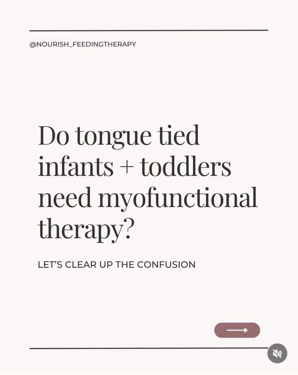Is your little one struggling with airway symptoms, and you were told they’re too young for Myo? You just need the right provider, who has the scope and training to address myofunctional disorders in infants + toddlers..
😛 Symptoms of a myofunctional disorder:
History of tongue tie
Open mouth posture
Low tongue posture
High palate
Excessive drool
Enlarged adenoids/tonsils
Chronic ear infections or middle ear fluid
Poor sleep
Hyperactivity
Feeding challenges or picky eating
Speech errors
Crowded teeth
Tongue thrust
Schedule a phone consult if your infant or toddler has a myofunctional disorder. I’d love to help. 💻