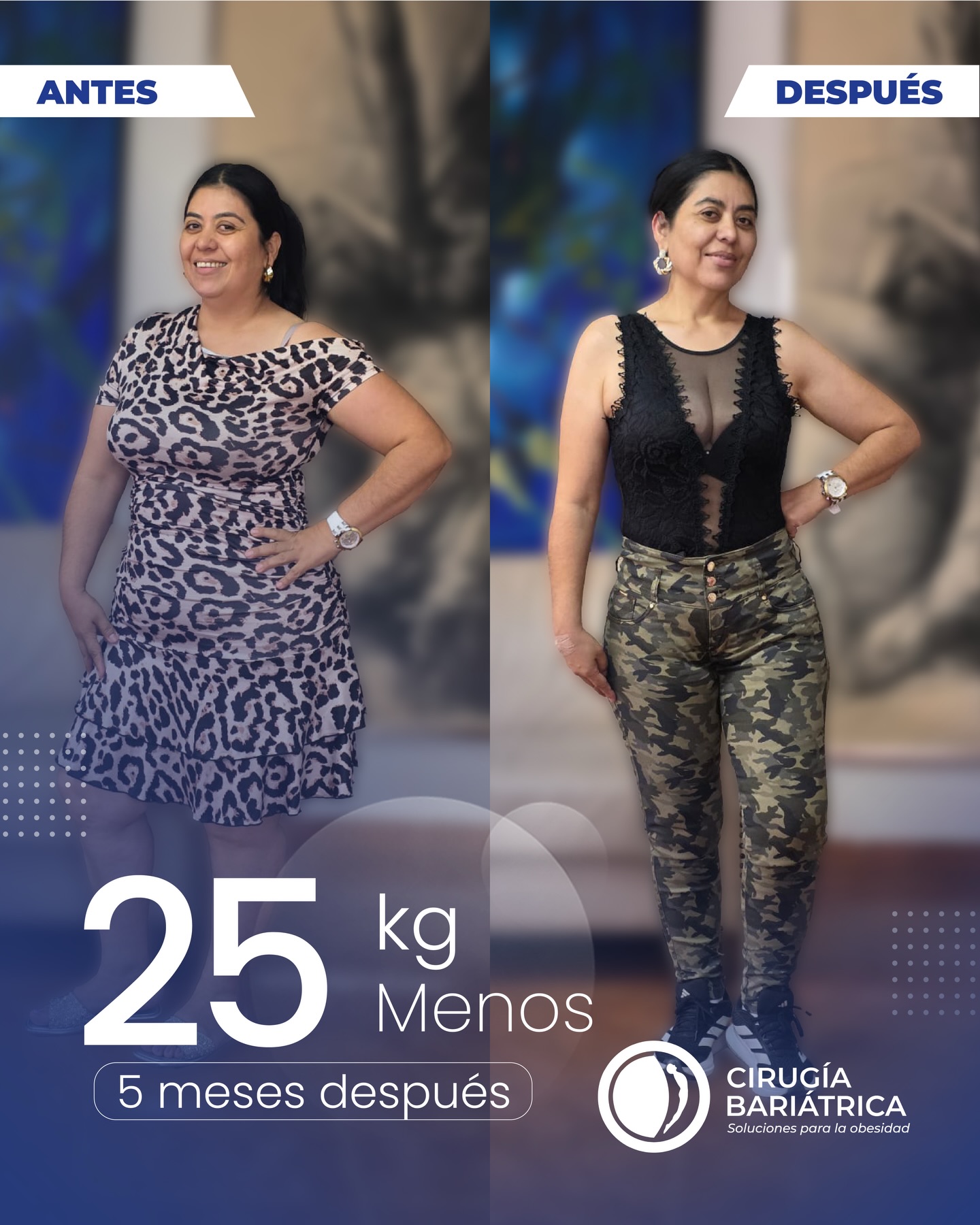 Gracias al acompañamiento del Dr. Eduardo Bolaños y su equipo, esta paciente hoy celebra una transformación no solo física, sino también emocional. Más salud, más fuerza, más vida. 💪💙
.
📍Agenda tu valoración y da el primer paso hacia tu mejor versión.
#bariatric #bariatricsurgery #bajardepeso #weightlosssurgery #cirugiabariatrica