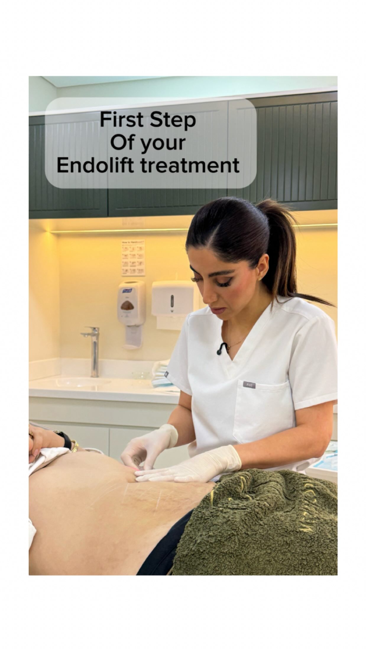 First and Most step of your
Endolift Treatment! ‼️
Do you benefit from this trea?
If yes, how would be the result??
Do you have better options?
.
.
.
#endolift #endoliftdubai
