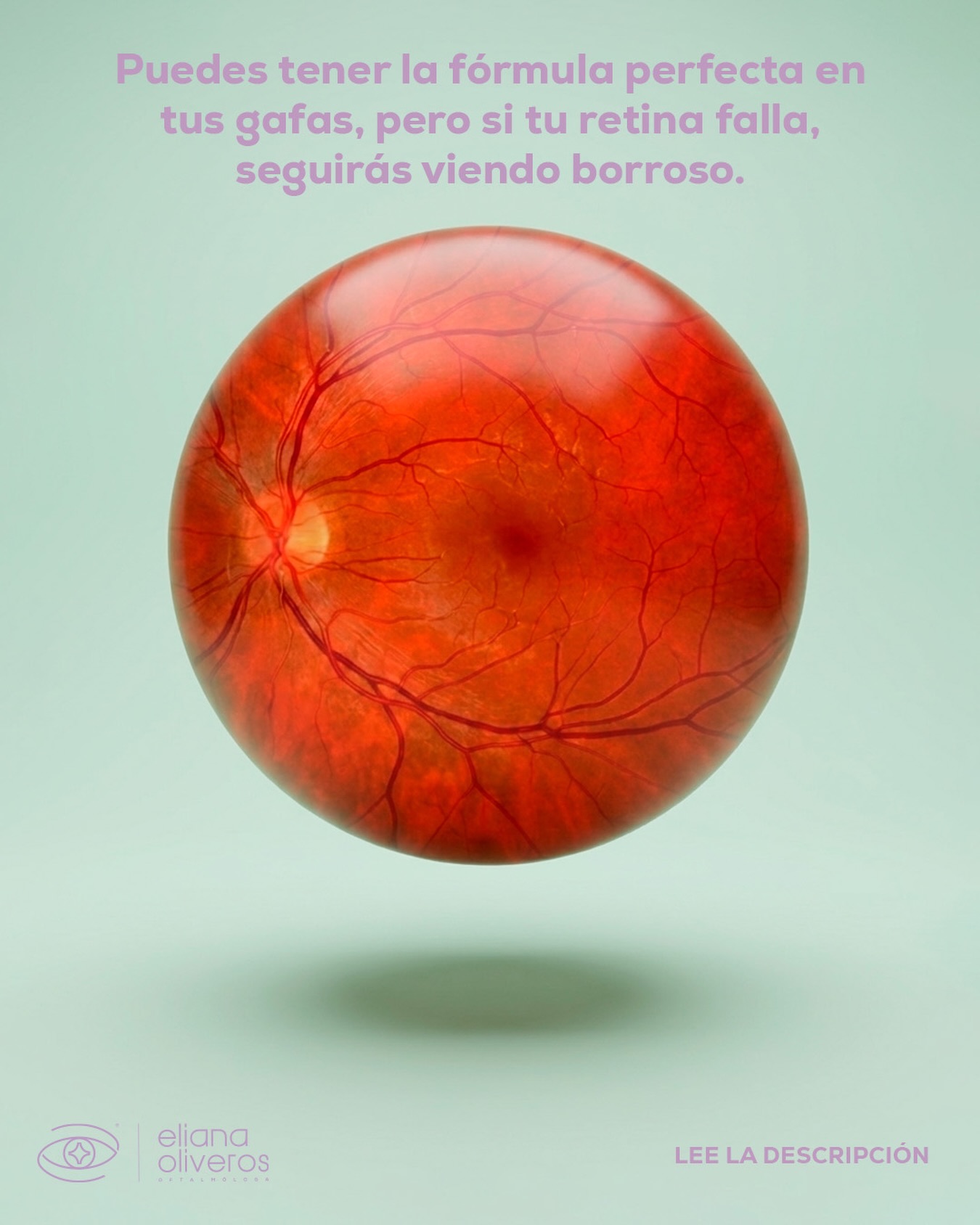 Piénsalo así: la retina es como el “rollo fotográfico” de tu ojo. Si no funciona correctamente al recibir la luz, tu visión se verá afectada incluso con la fórmula más precisa.
Por eso, no todo se soluciona en la óptica. Una evaluación oftalmológica completa nos permite descubrir la verdadera causa y cuidar tu salud visual desde adentro hacia afuera🔍🧑🏻⚕️
👉 Tienes el link en mi perfil para agendar tu próxima cita y mejorar tu visión