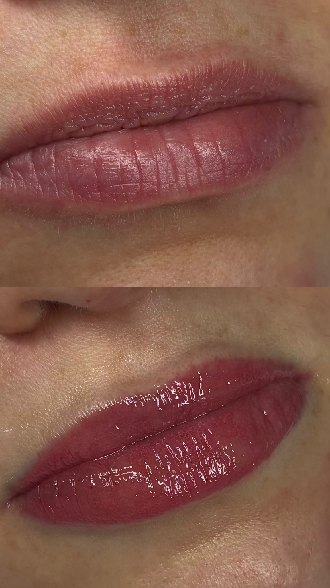Lip blush is a process…and trust it 💋✨
Right after your appointment, expect your lips to look more intense, a little swollen, and even slightly uneven in color, this is completely normal. Over the next few days, they’ll soften, peel, and gradually fade into the most natural, flattering tint.
The healed result? Effortless color, enhanced shape, and that “your lips but better” glow.
Patience = perfection 🤍
#lipblush #pmulips #lipblushhealing #trusttheprocess #medspa beautyjourney naturalbeauty beforeandafter healedresults aestheticclinic
