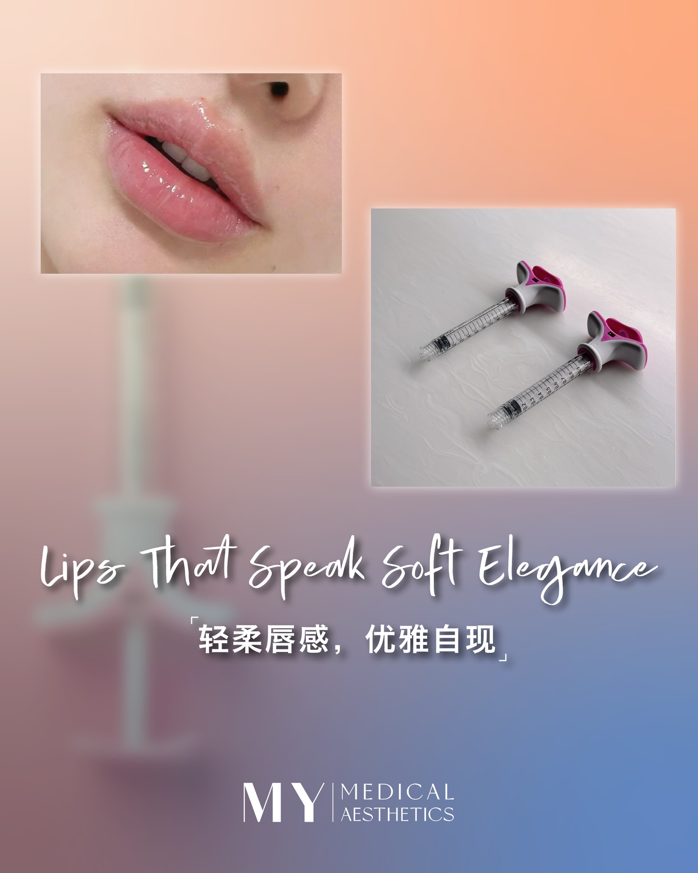 Feel like your lips look flat and lacking definition?
Maybe it’s time for a subtle upgrade ✨
💋 Enhance your lip contours
💋 Add natural volume
💋 Create a soft, lifted 3D look
Not overdone, just the right touch of refinement.
Let your lips gently lift and elevate your overall look ✨
DM us to explore the perfect lip enhancement for you 💌
· 𝐌𝐘 𝐌𝐄𝐃𝐈𝐂𝐀𝐋 𝐀𝐄𝐒𝐓𝐇𝐄𝐓𝐈𝐂𝐒 ·
总觉得嘴巴干扁、不够立体?
是时候让轮廓更精致一点了 ✨
💋 轻轻提升唇部线条
💋 增加自然饱满度
💋 打造柔和又精致的立体感
不是夸张改变,而是刚刚好的精致提升。
让嘴唇自然“翘”起来,气质也跟着升级 ✨
DM我们,了解最适合你的唇部方案 💌
#mymedicalaesthetics #medicalaesthetics #aestheticclinicsg