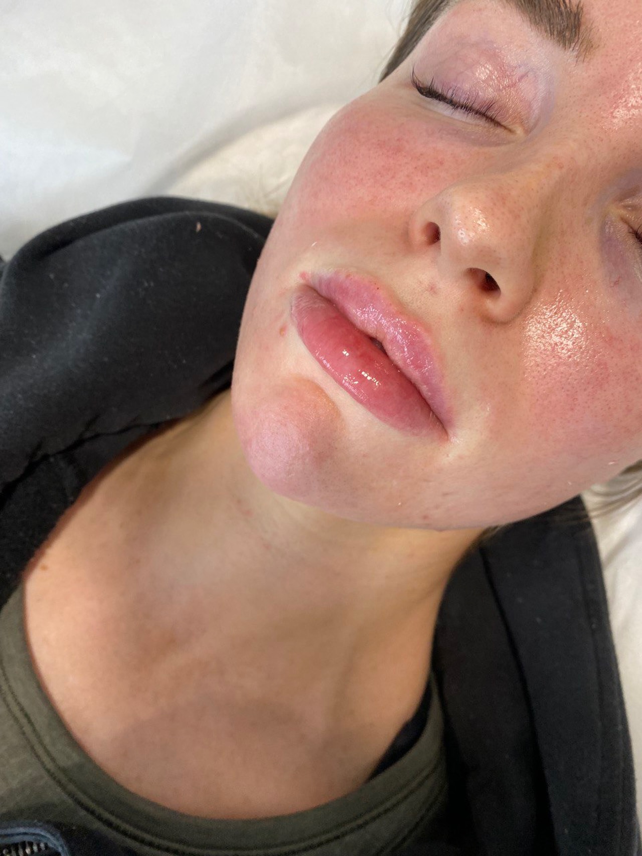 Not everyone needs big lips.
Not everyone needs fillers.
At our clinic, we focus on what you actually need — not trends.
We believe in:
• Natural results
• Personalised treatments
• Enhancing, not changing
From skin quality to subtle refinements, our goal is simple:
the best possible outcome at a price that makes sense.
Because real beauty is not one-size-fits-all. ✨