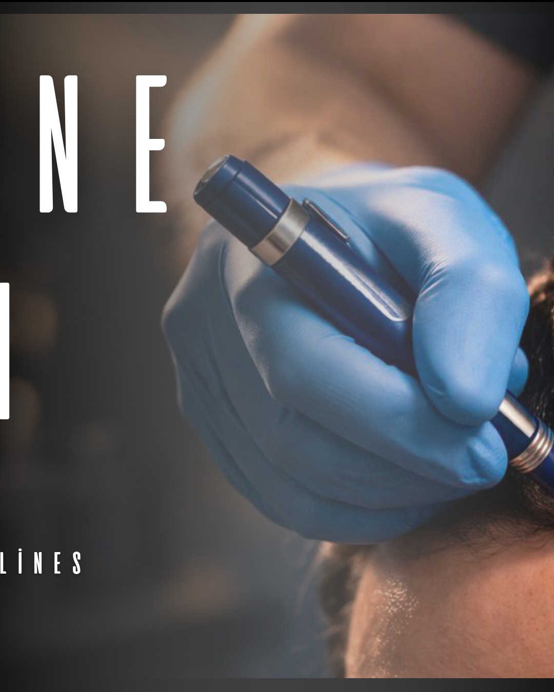 Design Your Hairline. Define Your Identity.
#HairlineDesign
#NaturalHairline
#HairTransplantTurkey
#HairlineGoals
#PerfectHairline