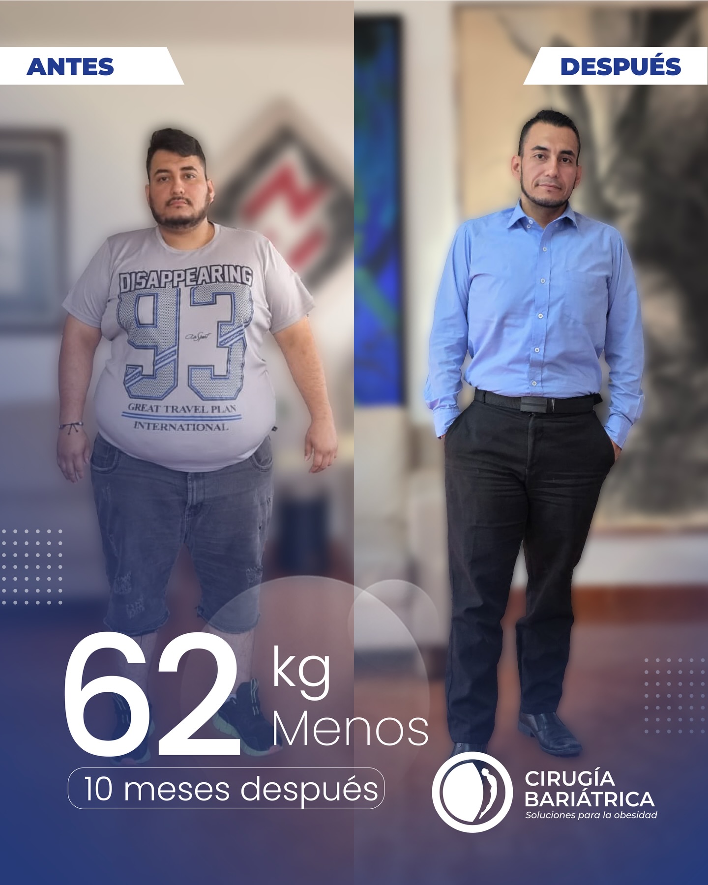 62 kilos menos en 10 meses… un resultado que trasciende lo estético y refleja una verdadera evolución en salud ✨💯
Gracias a la cirugía bariátrica realizada por el Dr. Eduardo Bolaños y su equipo, el paciente inicia una nueva etapa con mayor bienestar, energía y una notable mejora en su calidad de vida 💪✨
Con el respaldo de tecnología avanzada, experiencia médica y un enfoque integral en el seguimiento, se evidencian resultados reales y sostenibles en el tiempo ✅🏆
📍Agenda tu valoración y comienza tu proceso hacia una mejor salud.
#bariatric #bariatricsurgery #bajardepeso #weightlosssurgery #cirugiabariatrica