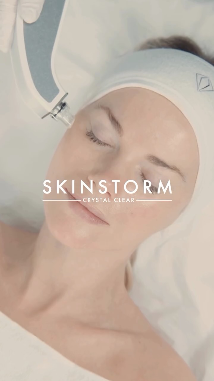This is not just a facial. This is SKINSTORM.
A world-first, patented system combining six advanced technologies in one protocol to
transform skin quality with no downtime.
Oxygen skin saturation. Cryotherapy needling. Clinical resurfacing. Drone technology
infusion. High-pressure skin boosting. Advanced phototherapy.
Each element works in synergy to:
• Intensively hydrate and oxygenate
• Smooth texture and refine pores
• Improve pigmentation and clarity
• Stimulate collagen and strengthen skin structure
• Deliver instant plumpness and long-term skin health
The result is skin that looks firmer, clearer, more radiant and visibly rejuvenated from the
very first treatment.
Your skin requires oxygen to function at its best. SKINSTORM restores what time takes
away.
Six technologies. One bespoke treatment. Real results.
Book your SKINSTORM treatment today.
#SkinStormFacial #AdvancedFacials #GlowUpSkin #BeautySalonUK #AntiAgingSkin SkinCareExperts FormbyBeauty LiverpoolSkin