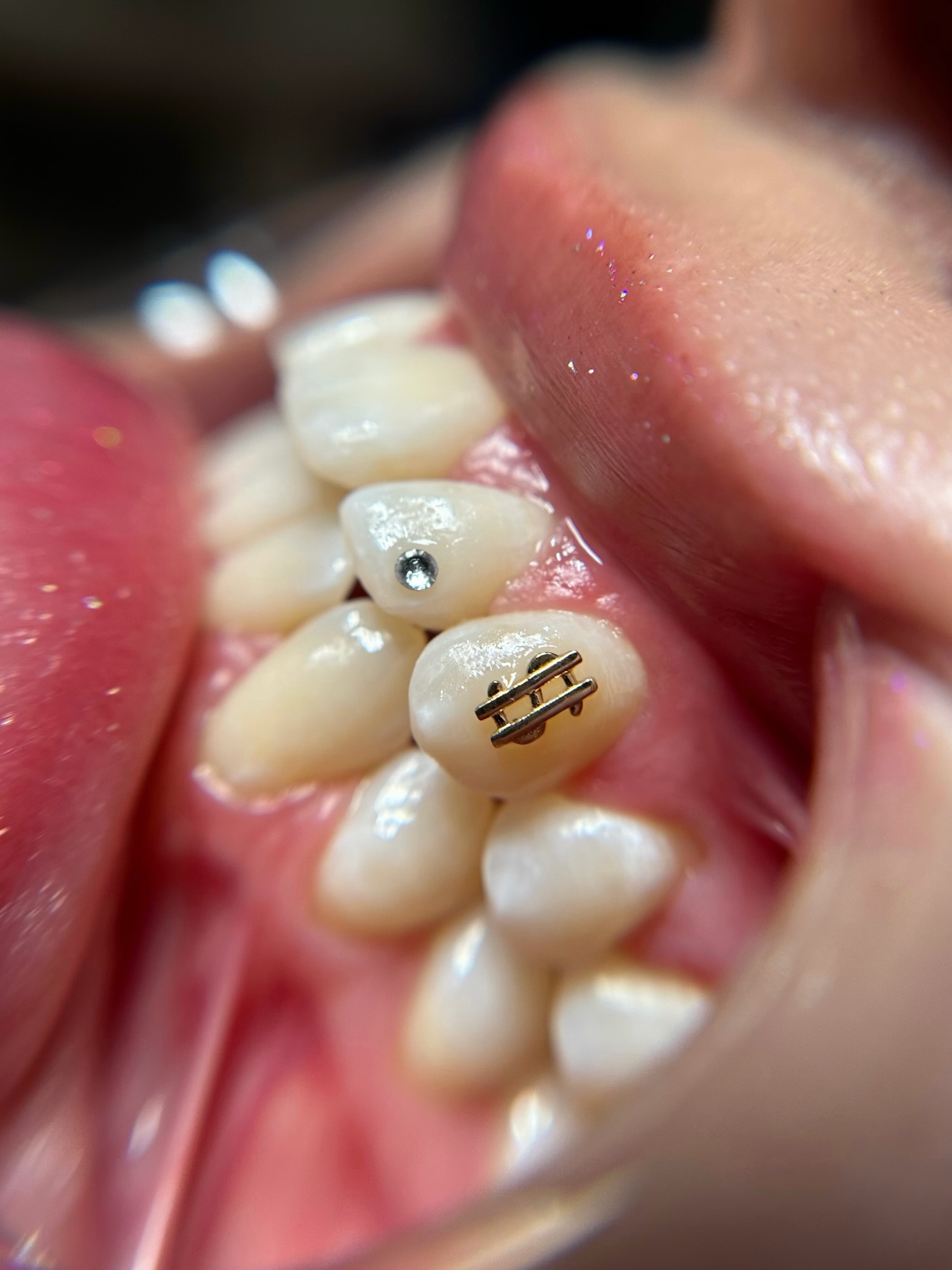 they don’t just add sparkle… they change your whole smile ✨🦷
naperville | chicagoland
book your glow when you’re ready 💎
#teethwhiteningnaperville
#toothgemsnaperville
#chicagolandbeauty
#toothgems
#napervillebeauty