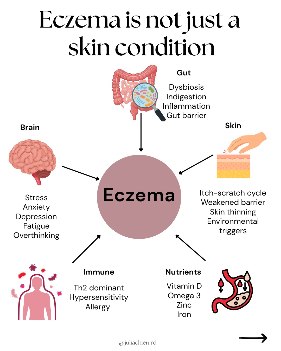 Comment ECZEMA and I’ll send you a podcast episode that explains more on the gut-brain-skin connection 🧠✨
Comment LABS for the episode on labs that matter for eczema 🧪
And follow @juliachien.rd for more eczema, gut and nervous system content!
#eczemahealing #gutskinconnection #inflammationhealing #gutbrainconnection #rootcausehealing
