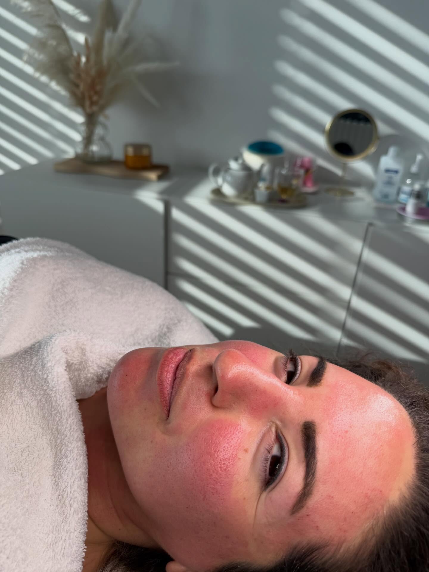 Glow in progress ✨
Ein Hauch von Rötung zeigt: Die Haut arbeitet.
Microneedling, das die Hauterneuerung aktiviert
Our Beautiful Rihab
#beauty #microneedlingtherapy #skin #happiness