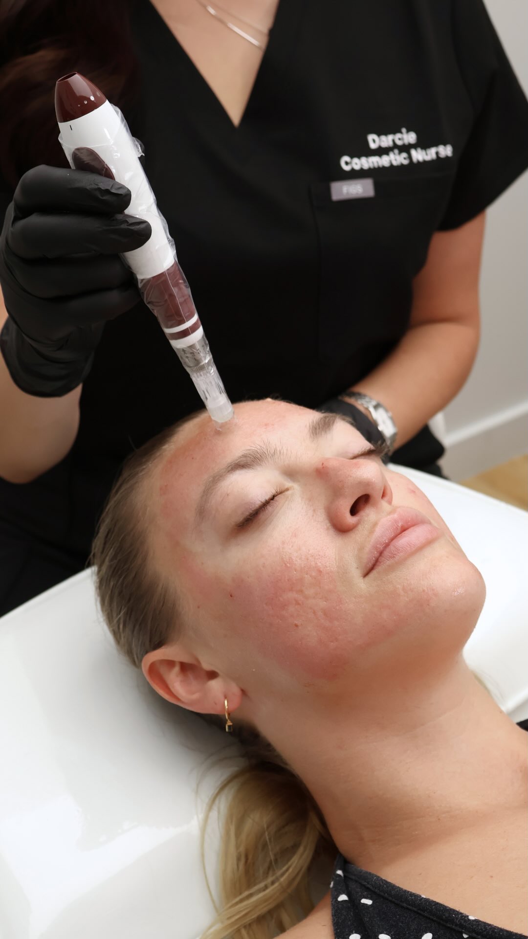 Exosomes are quickly becoming the secret behind advanced skin regeneration and for good reason.
At Enhanced by Darcie, we use Exosomes to support the skin at a cellular level, helping to accelerate repair, reduce inflammation and improve overall skin quality.
These powerful messengers work by stimulating your skin’s natural regenerative processes, enhancing results from treatments and supporting faster recovery.
Think stronger, healthier, more resilient skin with improved texture, tone and clarity over time.
This is a more advanced, results-driven approach to skin focused not just on how your skin looks, but how it functions.
If you’re looking to elevate your treatment outcomes and support long-term skin health, Exosomes are a game changer. 🤍 🔗