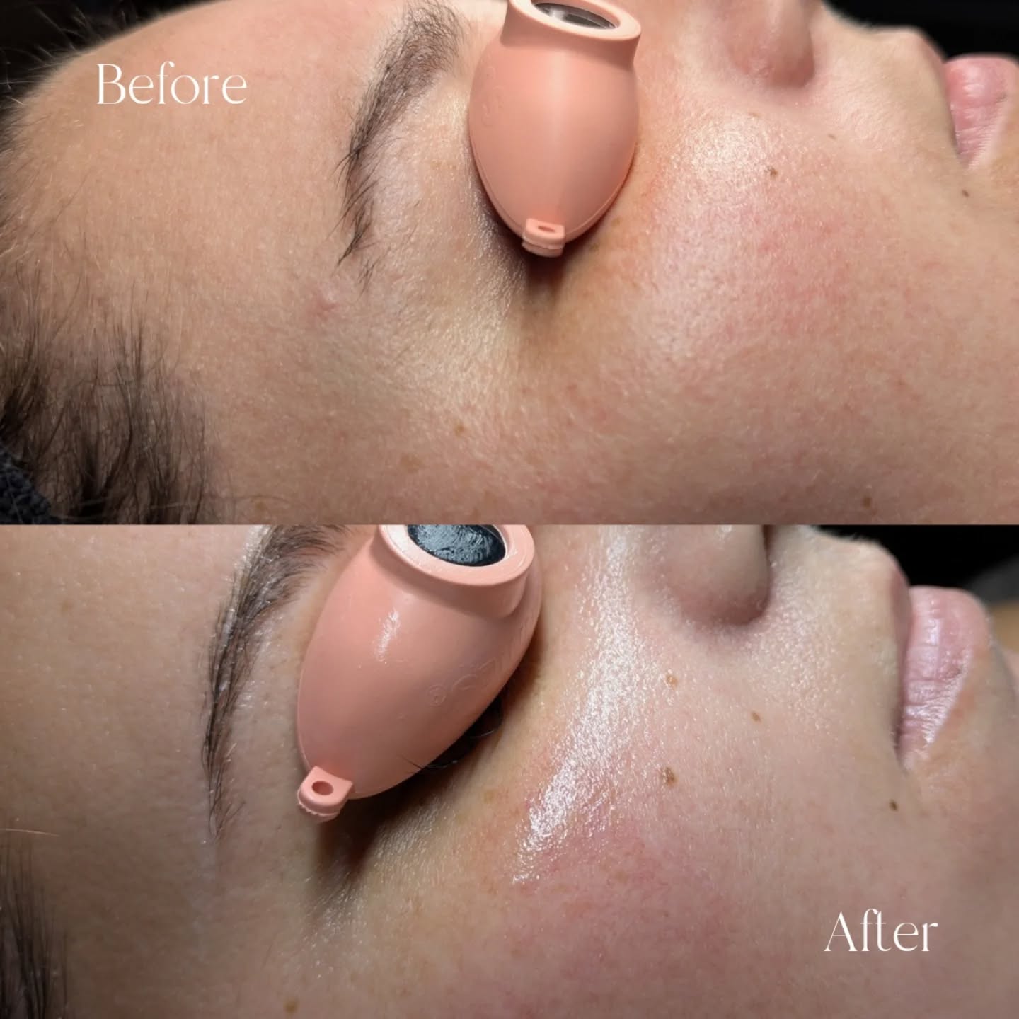 Home care, home care, home care.
It's amazing what a custom home care routine designed just for your skin needs can do.
Let's get started on your custom routine today. Contact me through the link in bio or DM me.
Santa Cruz based but virtual clients everywhere.