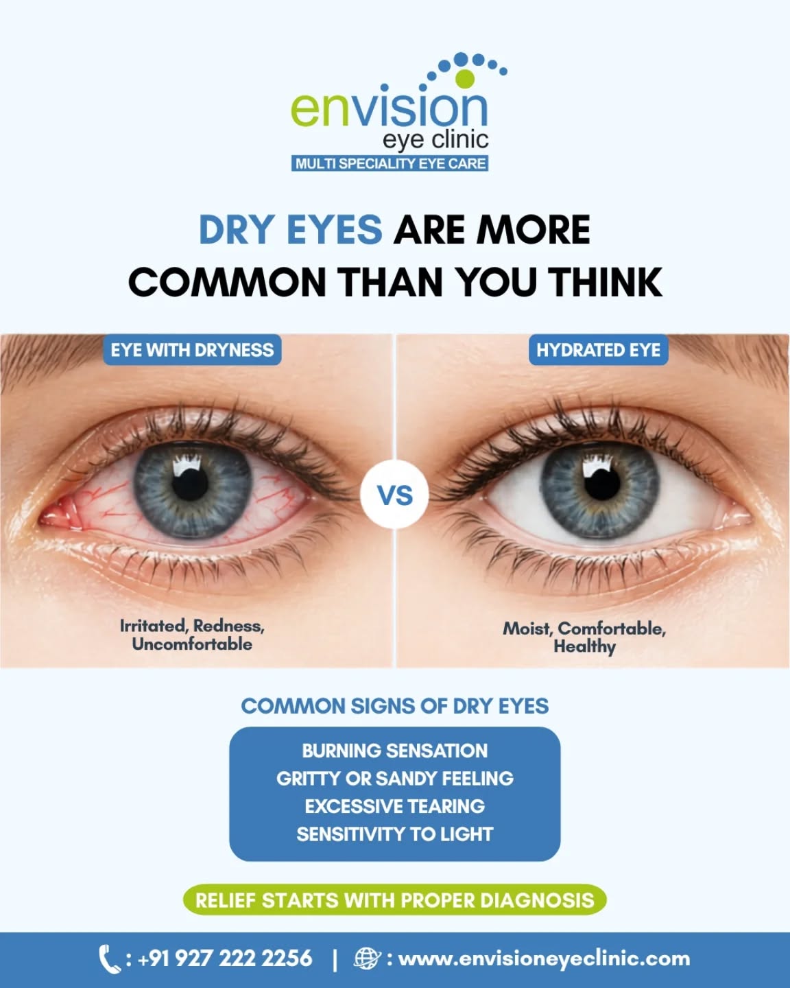 Dry eyes are more common than you think. Symptoms like burning, irritation, watering, or light sensitivity are often ignored but indicate poor tear quality or quantity. Early diagnosis can help manage discomfort and prevent long-term damage.
(dry eyes, eye irritation, burning eyes, watery eyes, light sensitivity, eye discomfort, tear film, eye dryness treatment)
📍 2nd Floor, Shivraj Apartments, near Parihar Chowk, Aundh, Pune, Maharashtra 411007
#DryEyes #EyeCare #EyeHealth #EnvisionEyeClinic #HealthyVision
