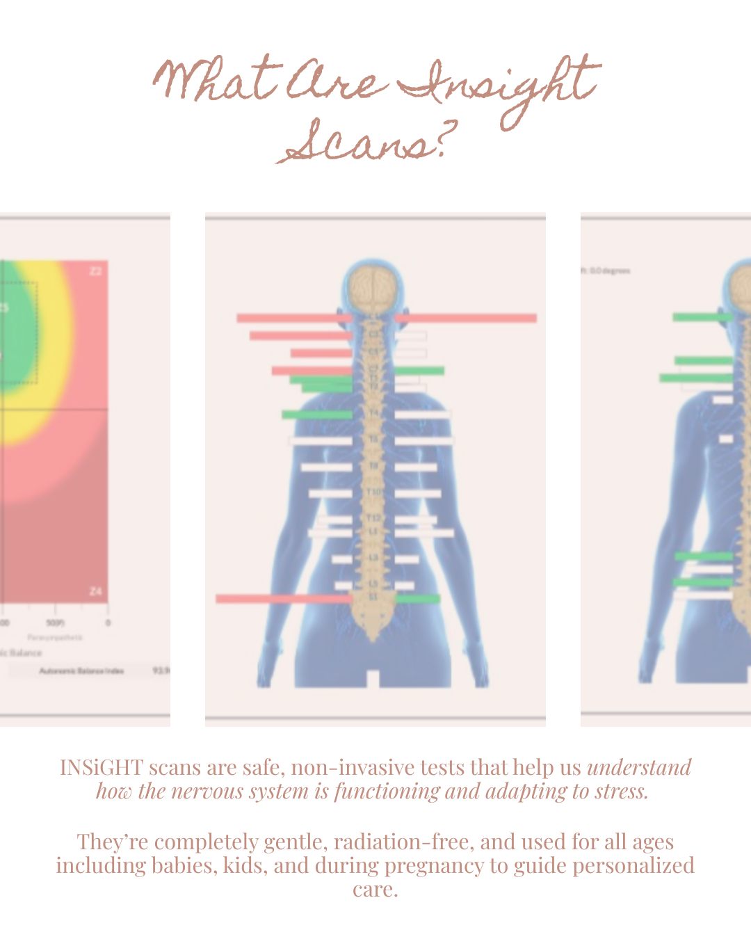 Insight scans allow us to understand and track how efficiently the nervous system is coordinating the regulatory systems of the body.
The exam consists of 3 scans:
Thermography - measuring temperature differences at the skin surface
Surface Electromyography - measuring the electrical activity in the paraspinal muscles
Heart Rate Variability - measuring stress and tone of the nervous system
Understanding these scans allows us to see signs of dysregulation happening and recommend care based on objective outcomes!
Getting adjusted changes how our body is able to function and regulate over time, and as the scans show better coordination most of the symptoms that were showing up at the start of care, heal as well. This neuro-functional approach allows us to not only help you feel better, but also changes how your body will adapt to future stresses as we move through life.
We love to nerd out about the scans so let us know if you have any questions or if you’d like to see how well your body is functioning!