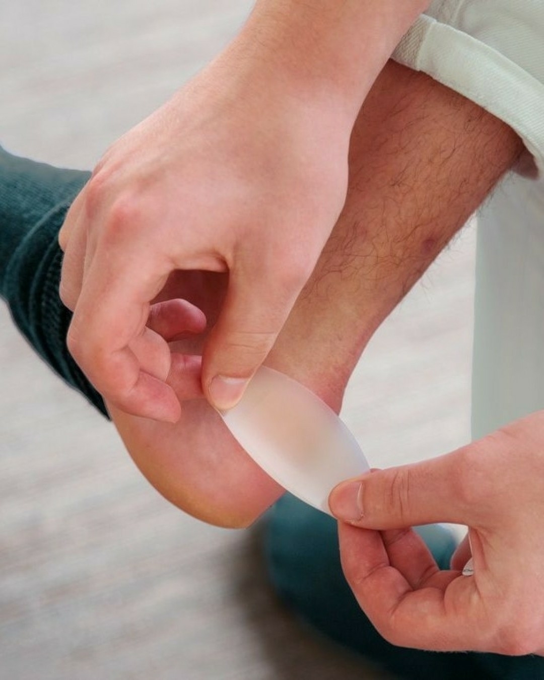 👣 Blister care at home – what you need to know
Blisters can be painful, but it’s best not to pop them. The outer skin acts as a natural barrier, protecting against infection. If a blister does burst, keep the skin in place, clean the area, and cover it with a bandage — hydrocolloid dressings work especially well for cushioning and healing.
⚠️ See a podiatrist if you have diabetes, or if you notice multiple, recurring, or unusual blisters, or any signs of infection like redness or pus.
Taking care early helps prevent bigger problems later.
www.surfcoastpodiatry.com