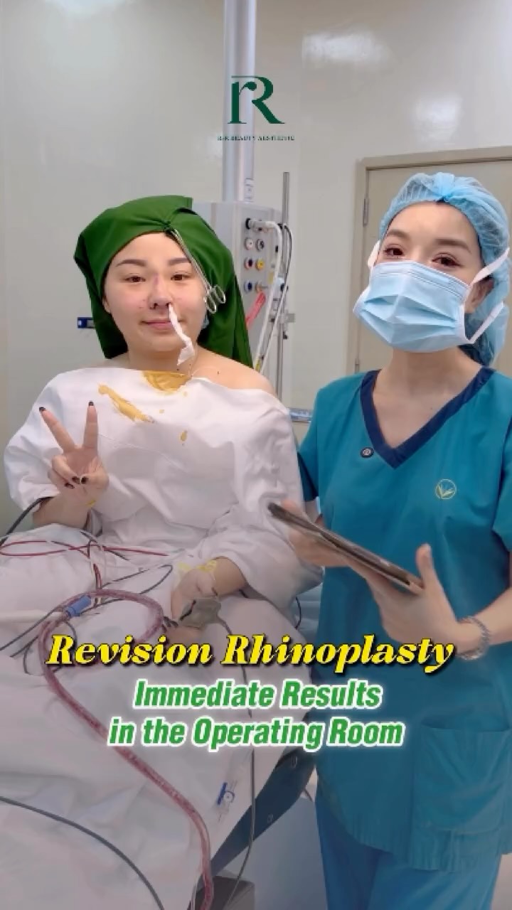 Just finish redo Singapore customer
R&R beauty Clinic
Vietnam Medical Tourism.
Vietnam Clinic
R&R Beauty Aesthetic / R&R Beauty Clinic
📍 10A Truc Duong, An Khanh Ward, Ho Chi Minh City, Vietnam
Singapore Studio
R&R Beauty Studio
📍 416 Ang Mo Kio Ave 10, #01-985, Singapore 560416
#rhinoplastybeforeandafter #rhinoplastie #rhioplastyresult
medicaltourism plasticsurgery fatremoval rrbeautystudio