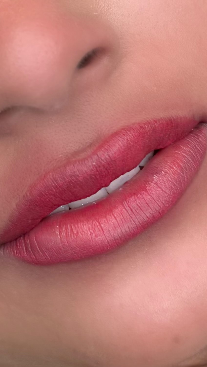 At Timeless by Trinh. We empower women by providing fully customized results for clients based on their goals, needs and insecurities.
It's not just one fits all, it's about enhancing YOUR natural beauty.
I want to make your comfortable in your own skin all day, everyday.
If you want to know more about Lip blushing / Lip neutralizing send me a DM. i'd be happy to discuss more about your goals and if we're a good fit for eachother. 🌹
#lipneutralizing #lipblushing #torontobeauty #torontolipblush