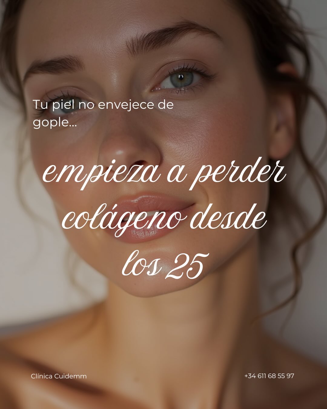 “No es cuándo tratar… es cuándo empezar.”
📍 Valoración con el Dr. Martín
Muchas pieles llegan tarde.
No porque no se hayan cuidado…
sino porque nadie les explicó cuándo era el momento adecuado para empezar.
Hoy sabemos que prevenir no es hacer tratamientos sin criterio.
Es hacer el tratamiento correcto, en el momento correcto.
Y ahí está la diferencia.
🔬 No todos los inductores de colágeno actúan igual.
No tienen la misma profundidad, ni la misma indicación, ni el mismo objetivo.
👉 Elegir mal no es que no funcione…
es que no estás tratando lo que realmente necesitas.
Por eso, antes de hablar de tratamiento,
hablamos de diagnóstico.
Con el Dr. Martín, la valoración no es un trámite:
es lo que define cómo va a envejecer tu piel.
Sin sobretratar.
Sin cambiar tu expresión.
Con un enfoque progresivo y natural.
Porque cuidarse bien no es hacer más.
Es hacerlo con criterio.
📍 Clínica Cuidemm
📩 Escríbenos por DM y te asesoramos sin compromiso