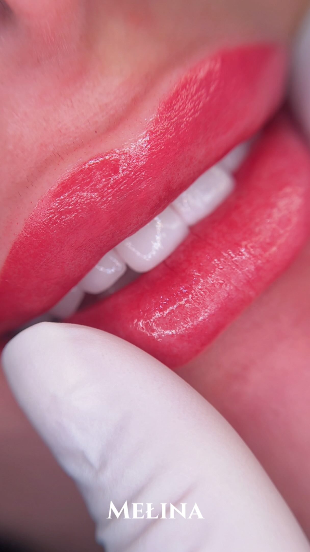 Lip Blush is the perfect choice for anyone who wants naturally defined, soft, and flawless lips. 🌸🌸
, the color settles beautifully under the skin and becomes even more natural after 30 days.
Your pigment is carefully selected based on your skin tone to enhance your natural beauty without looking heavy or artificial.
Benefits of Lip Blush:
• Enhances the natural shape of the lips
• Adds soft, natural color that lasts
• Corrects asymmetry and pale lips
• Gives a youthful, fresh look
• Reduces the need for daily lipstick
• Fully customized pigment based on your skin tone
• Heals naturally and looks better with time
Send a picture of your lips without lipstick for a consultation 🌹
#تاتو_الشفايف #ليب_بلش #ميكروبليدينج_الشفايف تجميل_دبي خدمات_تجميل صبغة_شفايف lipblush dubaiartist lipblushtattoo permanentmakeup pmuartist dubaipmu naturallips softlips makeupartis