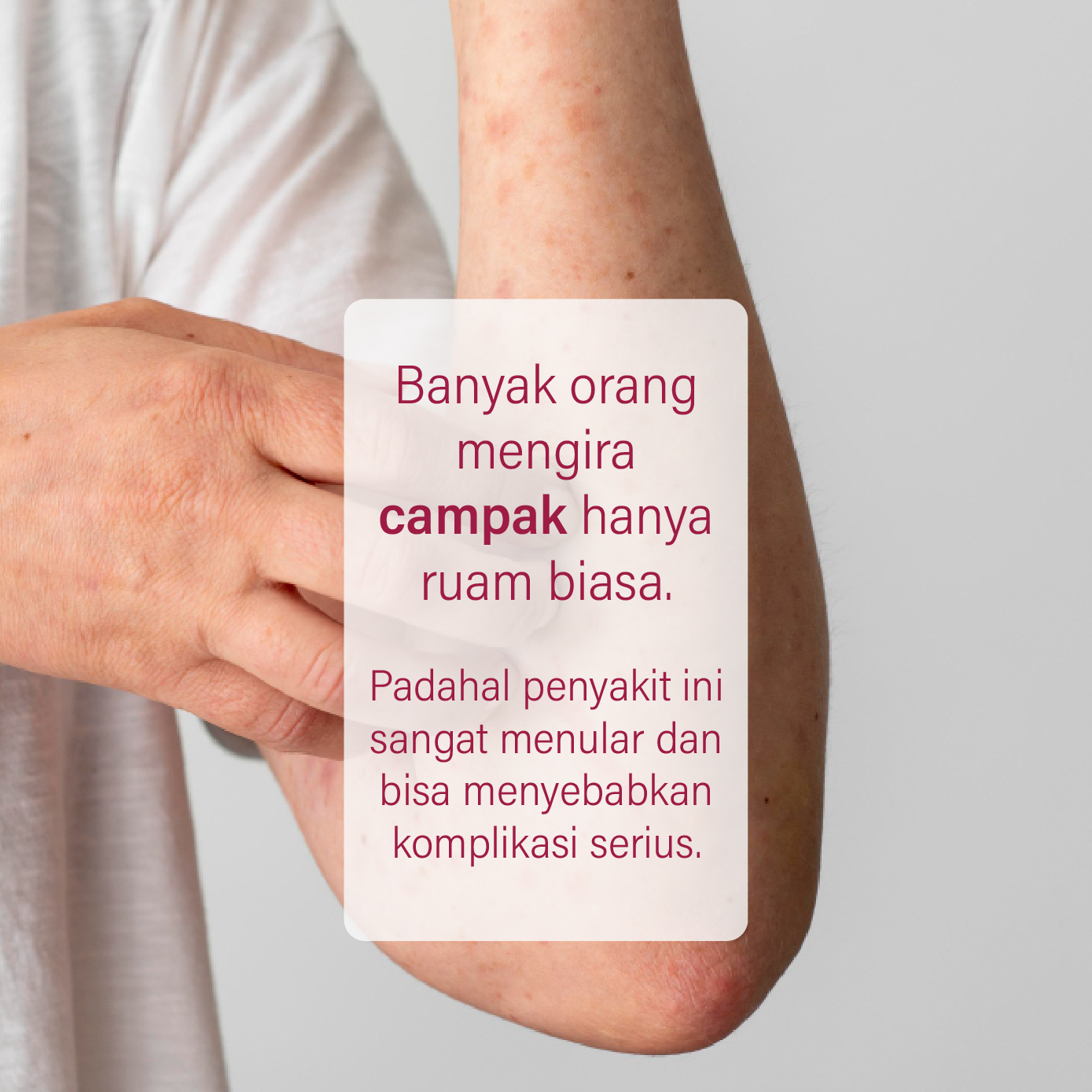 Campak bukan sekadar ruam biasa. Penyakit ini sangat menular dan dapat menyebabkan komplikasi serius, terutama pada anak-anak.
Lindungi diri dan keluarga dengan imunisasi lengkap 💉