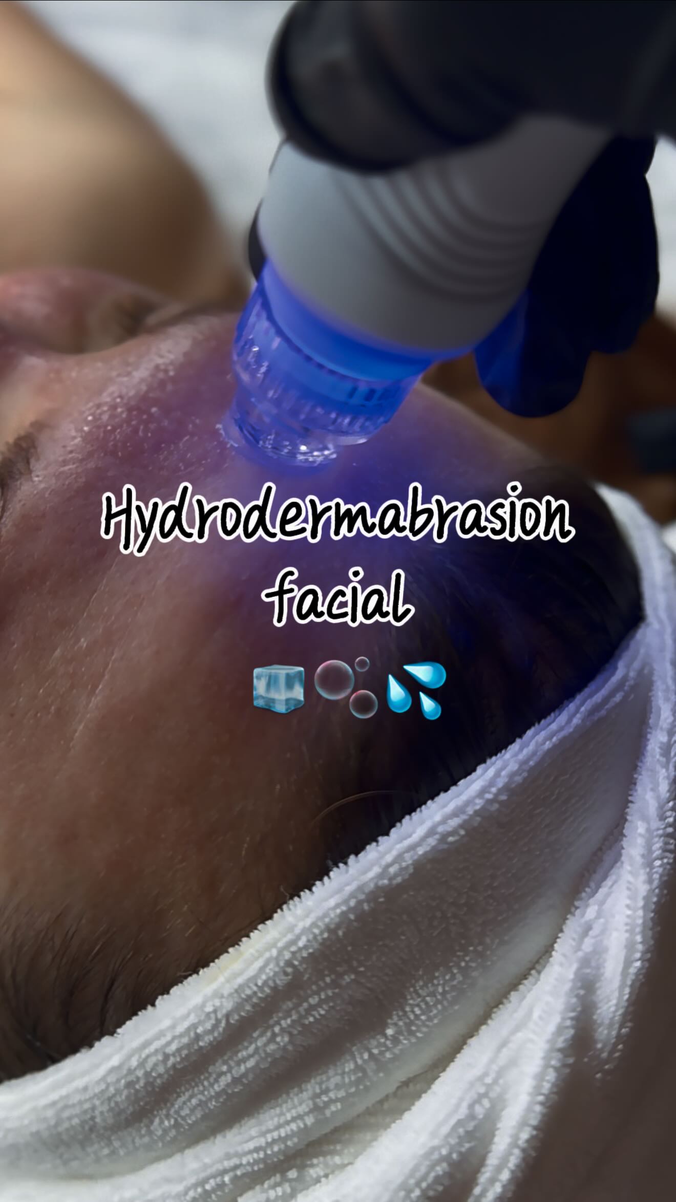 One Hydra Facial session = clean, smooth, glowing skin 💙🧖🏻♀️✨💫
You can see the difference right away!
💌 DM to book your appoinment today
📍1042 Beacon St, Brookline, MA
@aernailbar
#boston #spa #facial #beauty #fyp