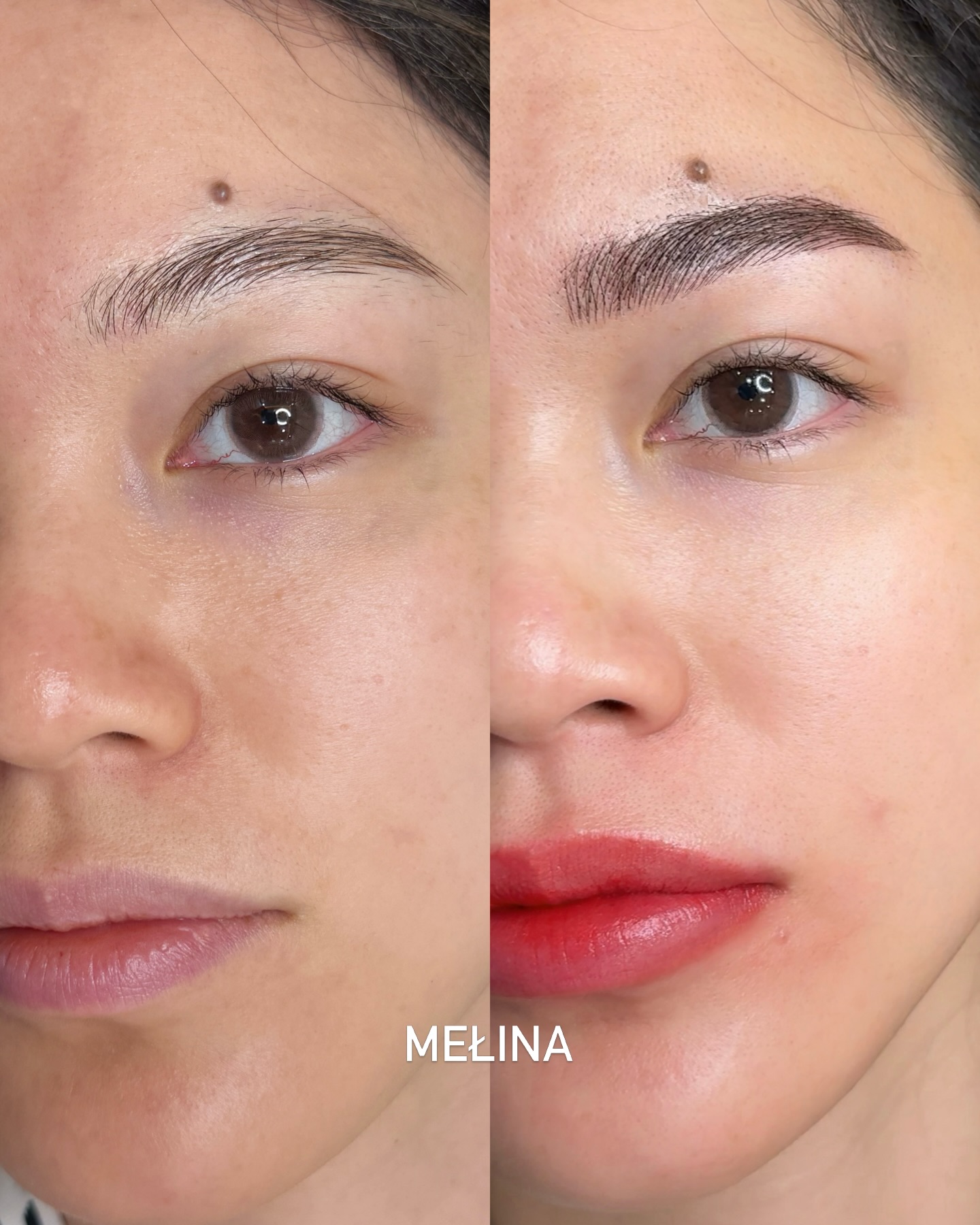 Look how her face has changed 😍
Do you think these fine strokes won’t heal and will disappear?
You can also see the healed results before the retouch ✨✅
Book your appointment with our combo offer for lips + eyebrows 🫶🏻🌹