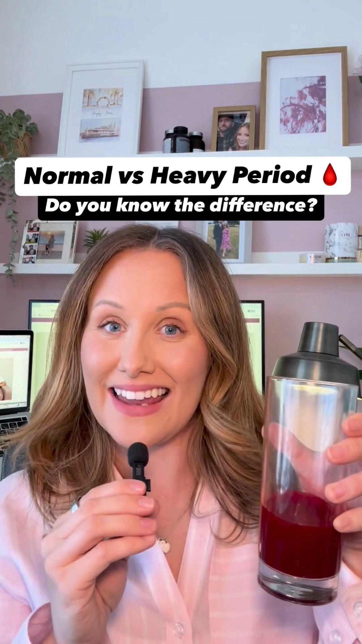 Heavy periods might be common… but that doesn’t mean they’re normal.
One of the biggest things I see in clinic?
So many women don’t actually know what a healthy period looks like.
So things like:
- changing products every hour
- flooding or large clots
- feeling wiped out every month
…just get brushed off as “part of being a woman.”
Over time, that mindset can leave you stuck, thinking this is just something you have to put up with.
But here’s what a lot of women don’t realise…
Heavy bleeding is often your body trying to tell you something.
And one of the most common underlying causes?
🩸Uterine fibroids.
What’s not talked about enough is this…
👉 there are ways to support your body alongside medical care.
That’s exactly why I created a free 20-minute training where I break it down simply:
💡 What a healthy period should actually look like
💡 Signs your hormones or cycle might be off
💡 5 practical diet & lifestyle strategies to support heavy bleeding
💬 Head to the link in my bio to watch, or comment FIBROIDS / send me a message and I’ll share it with you.