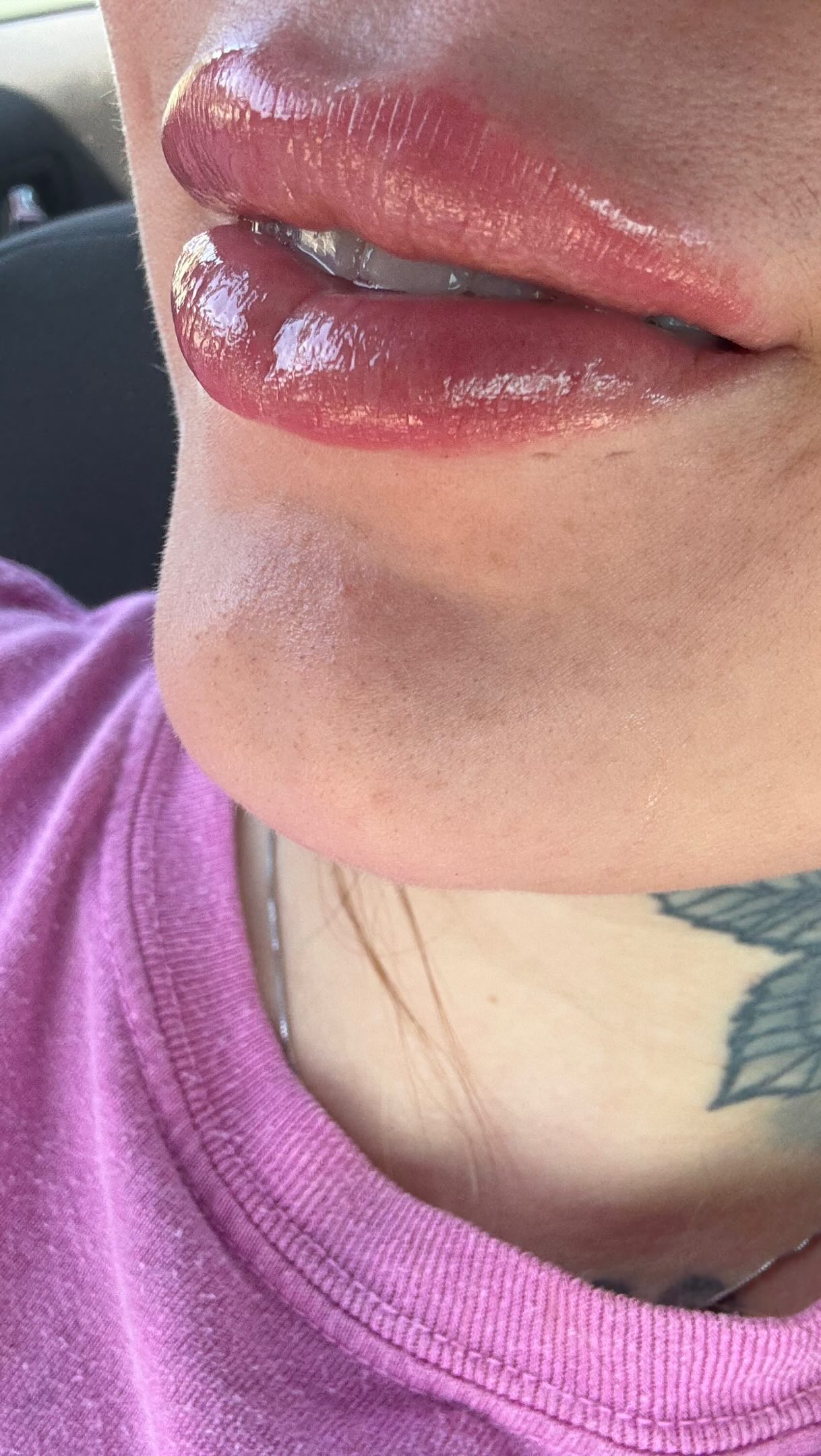 Mother’s Day special going on until May 14th !! Booking link in bio. If any questions plz dm me!! 💕🫶🏽🫶🏽 #lipfiller #microneedle #hyaluronpen #facialbalancing #tampalipfiller