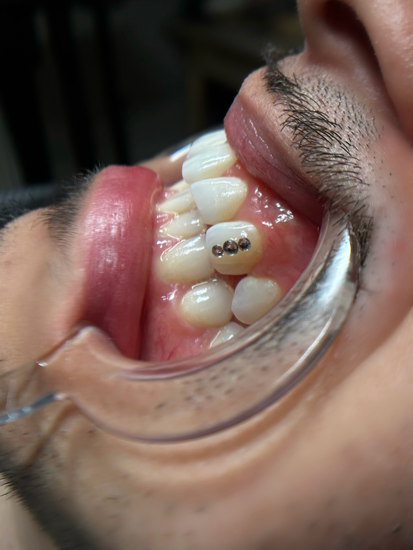 it is what it is… but this? clean. 😮🔥
#toothgemsnaperville
#napervilleil
#chicagolandbeauty
#toothgems
#mensstyle