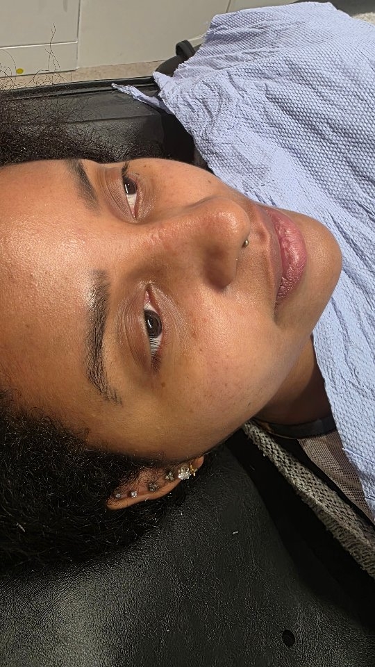 My client wanted to reduce the appreance of her tattooed freckles and improve overall skin texture... and here are the RESULTS 👌🏼... dewy skin, much clearer and healthier looking.
Trust the process and it will deliver results 🙏 ✨️
#Bristol #bristolfacials #clearskin #BeautyTips