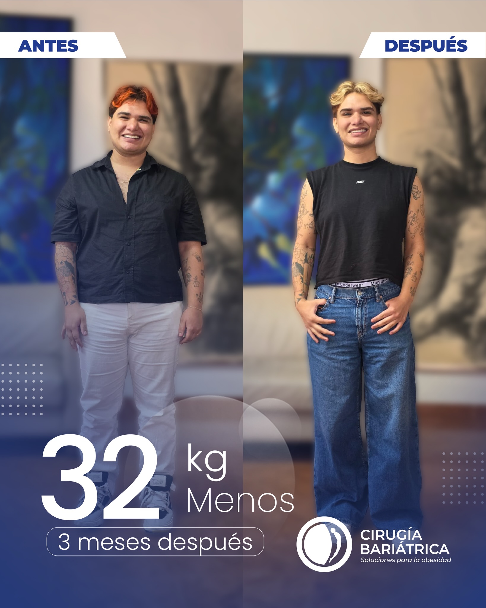 ¡Transformando vidas más allá de fronteras! 🌍 David Molina, hoy, celebra su camino hacia una vida más saludable, disfrutando de mejoras significativas en su salud. 👨🏻💼🤍
Contactos: +57 3155659167 | +57 3152887610 | Inglés o español ✅
#CirugíaBariátrica #Transformación #beauty