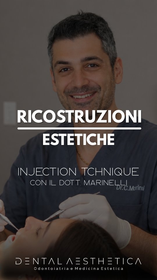 Sorriso nuovo senza dover limare i denti e senza dover applicare anestesia, ad un terzo del costo delle faccette senza rinunciare ad estetica e durabilità.
Sapevi inoltre, che è possibile provarle prima?
💡Ricostruzioni estetiche con injection technique
👨🏻⚕️Dott. Claudio Marinelli
Vieni a trovarci per una consulenza!
Dental Aesthetica
✨️ Odontoiatria e Medicina Estetica
📍 Viale della Grande Muraglia 256, zona EUR-Torrino
📱 375 88 47 069