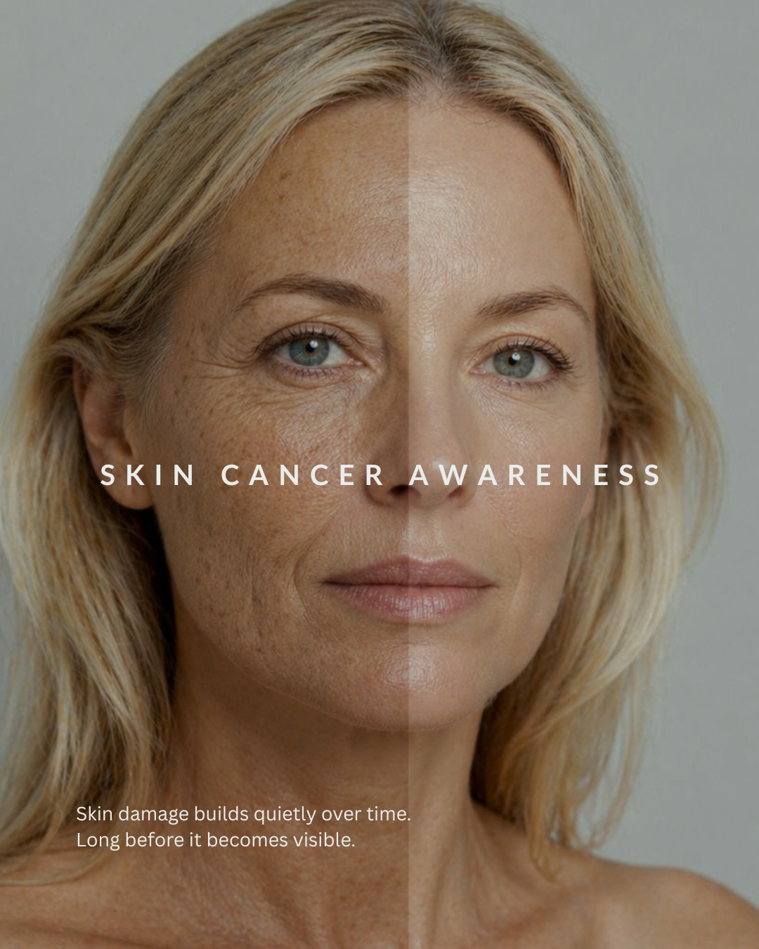 May marks Skin Cancer Awareness Month:
At Reborne, we consider skin not only as an aesthetic concern, but as a reflection of systemic health and long-term risk. Skin Cancer Awareness Month offers an opportunity to shift perspective, from reactive care to a more predictive, clinically guided approach.
We offer an advanced screening for deeper insight, designed to help identify signals associated with tumour activity, including those linked to melanoma, potentially before visible skin changes appear.
Used alongside your wider health profile, it offers an additional layer of information to support informed decisions.
Book your health consultation today via our website.