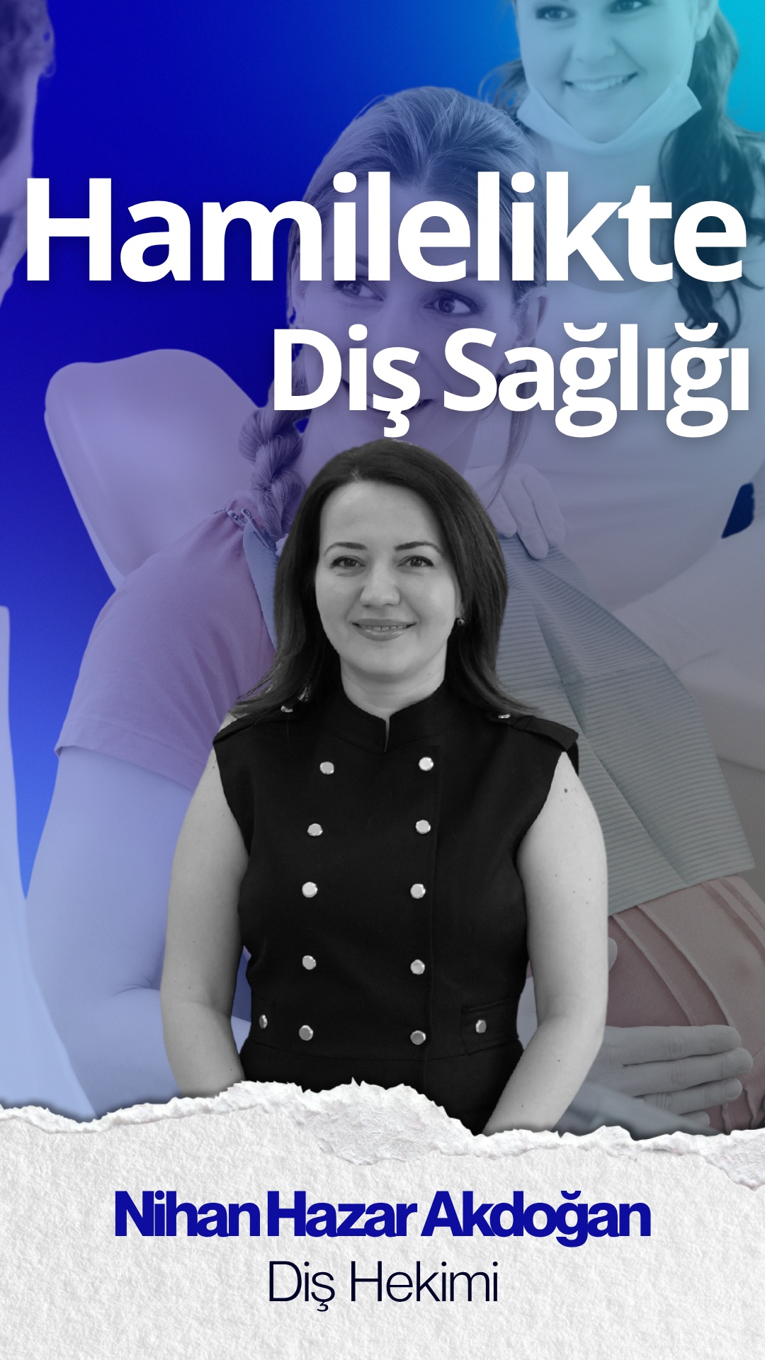🤍 Hamilelikte ağız ve diş sağlığı neden bu kadar önemli?
Anne olmak, daha dünyaya gelmeden başlayan özel bir yolculuk…
Bu süreçte değişen hormonlar yalnızca bedeni değil, ağız sağlığını da etkileyebilir.
Gebelik gingiviti; diş etlerinde kanama, hassasiyet ve şişlik gibi belirtilerle birçok anne adayında görülebilir. Ancak doğru bakım ve düzenli kontrollerle bu süreç sağlıklı şekilde yönetilebilir. ✨
Unutmayın; hamilelik dişleri bozmaz, ihmal edilen bakım sorun oluşturur.
Düzenli fırçalama, diş ipi kullanımı ve diş hekimi kontrolleri hem anne hem de bebeğin sağlıklı başlangıcı için büyük önem taşır. 🌸
Sağlıklı bir anne, sağlıklı bir başlangıç demektir.
Tüm annelerin ve anne adaylarının Anneler Günü kutlu olsun. 💐
👩⚕️ Dr. Nihan Hazar Akdoğan
#AnnelerGünü #HamilelikteDişSağlığı #GebelikGingiviti #DişEtiSağlığı #AnneAdayı #AğızSağlığı #DişHekimi #HamilelikSüreci #SağlıklıGülüş #NihanHazarAkdoğan