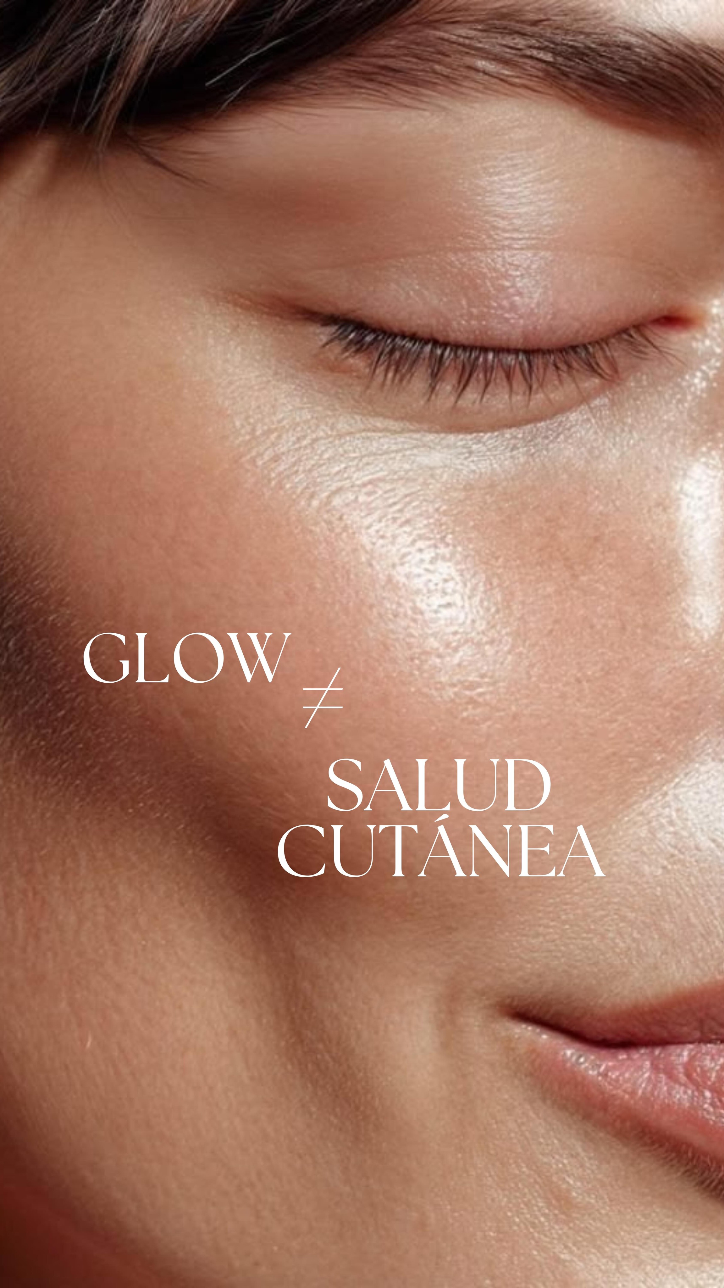 La tendencia “glass skin” puede comprometer la homeostasis cutánea.
El uso excesivo de exfoliantes químicos, retinoides u otros activos queratolíticos altera el manto hidrolipídico y favorece estados de irritación, eritema y disfunción de la barrera epidérmica.
A esto se suma una práctica cada vez más frecuente: la sobreaplicación de agentes oclusivos (como vaselina o aceites) con el objetivo de potenciar el “efecto glow”. Aunque pueden aportar confort de forma puntual, un uso indiscriminado puede generar oclusión excesiva, favorecer la aparición de comedones o agravar dermatosis en pieles no indicadas.
Una piel sana no es la que más brilla, sino la que mantiene su función barrera íntegra, su equilibrio lipídico y una adecuada tolerancia.
El brillo extremo no es un marcador de salud.
#Dermatología #SkinCare #GlassSkin #BarreraCutánea #PielSana