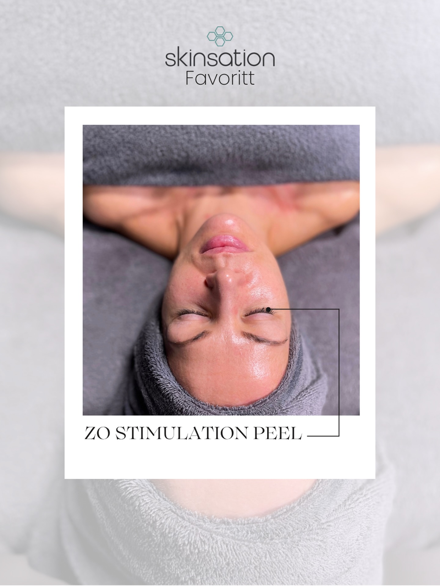 Vi feirer at @camilla_skinsation også har fullført ZO Expert sertifisering med @zoskinhealthnorway med en kampanje denne uken på deres signatur peeling: ZO stimulation peel 🦋 til KUN 990,-!
ZO stimulation peel passer alle hudtyper og gir en deilig glød, med jevnere hudtone, finere porer, glattere linjer og en freshere look. I tillegg sitter sminka sykt mye finere 🥹🦋🤌🏼🦄
Kampanjepris gjelder kun i uke 19 - så sikre deg behandling nå på www.skinsation.no🤍