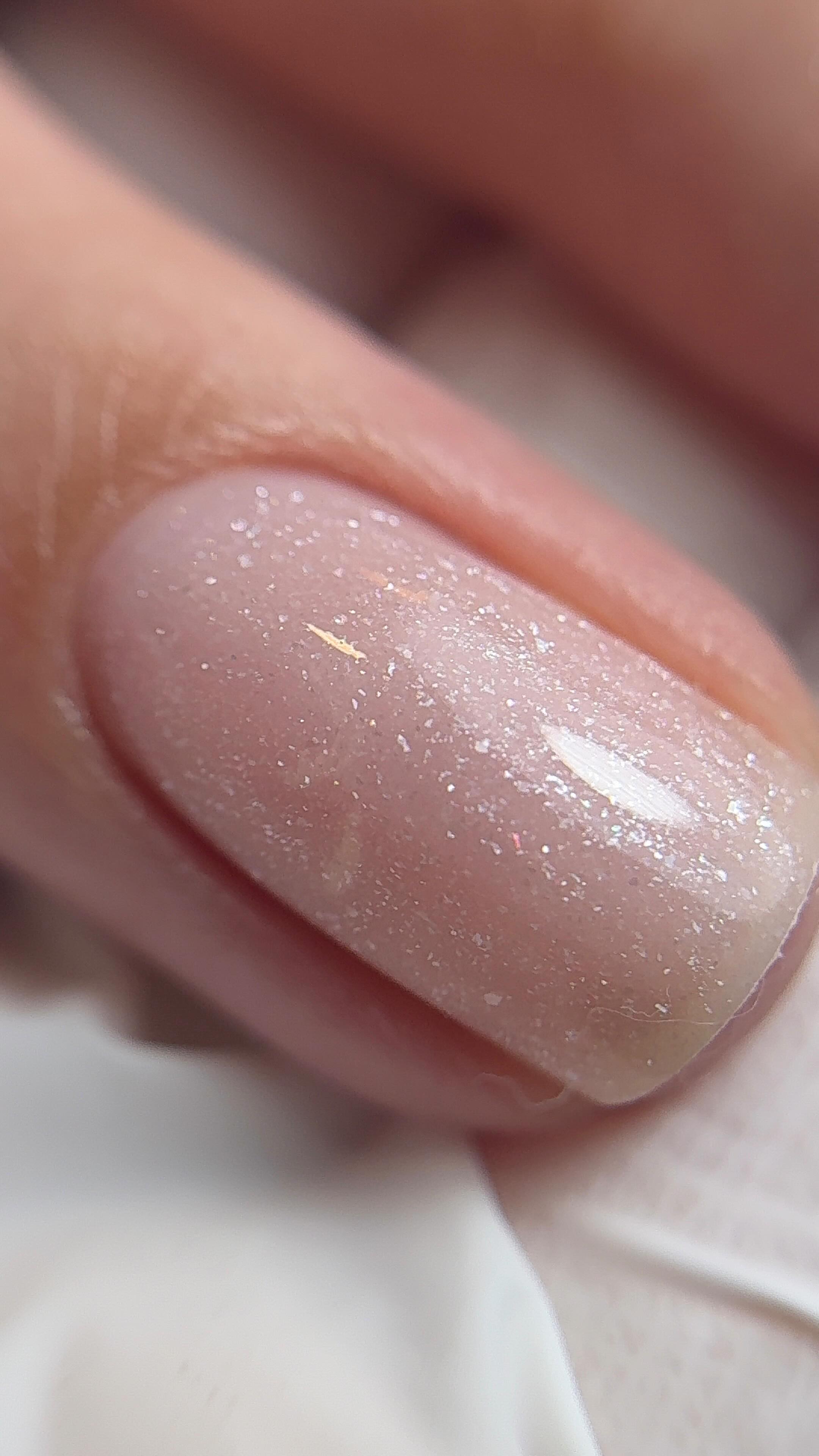 Gel allergies are more serious than people realise.
With the rise of DIY nails and cheap online products, more people are developing allergies from incorrect gel use and once an allergy develops, it’s permanent.
One of the biggest causes is repeated skin exposure to uncured gel.
This can happen from flooding the cuticle, improper application, under-curing, poor-quality products or not understanding how gel products should be used safely
A gel allergy isn’t “just irritation.”
In some cases, it can prevent people from wearing gel nails again altogether.
That’s why education, safe application, proper prep, and professional products matter SO much in this industry.
Being a nail tech isn’t just about creating pretty nails it’s about understanding how to work safely and protect your clients long-term.
#gelallergy #nailtech #naileducation #gelnails #nailtechlife uknailtech nailsafety diynails