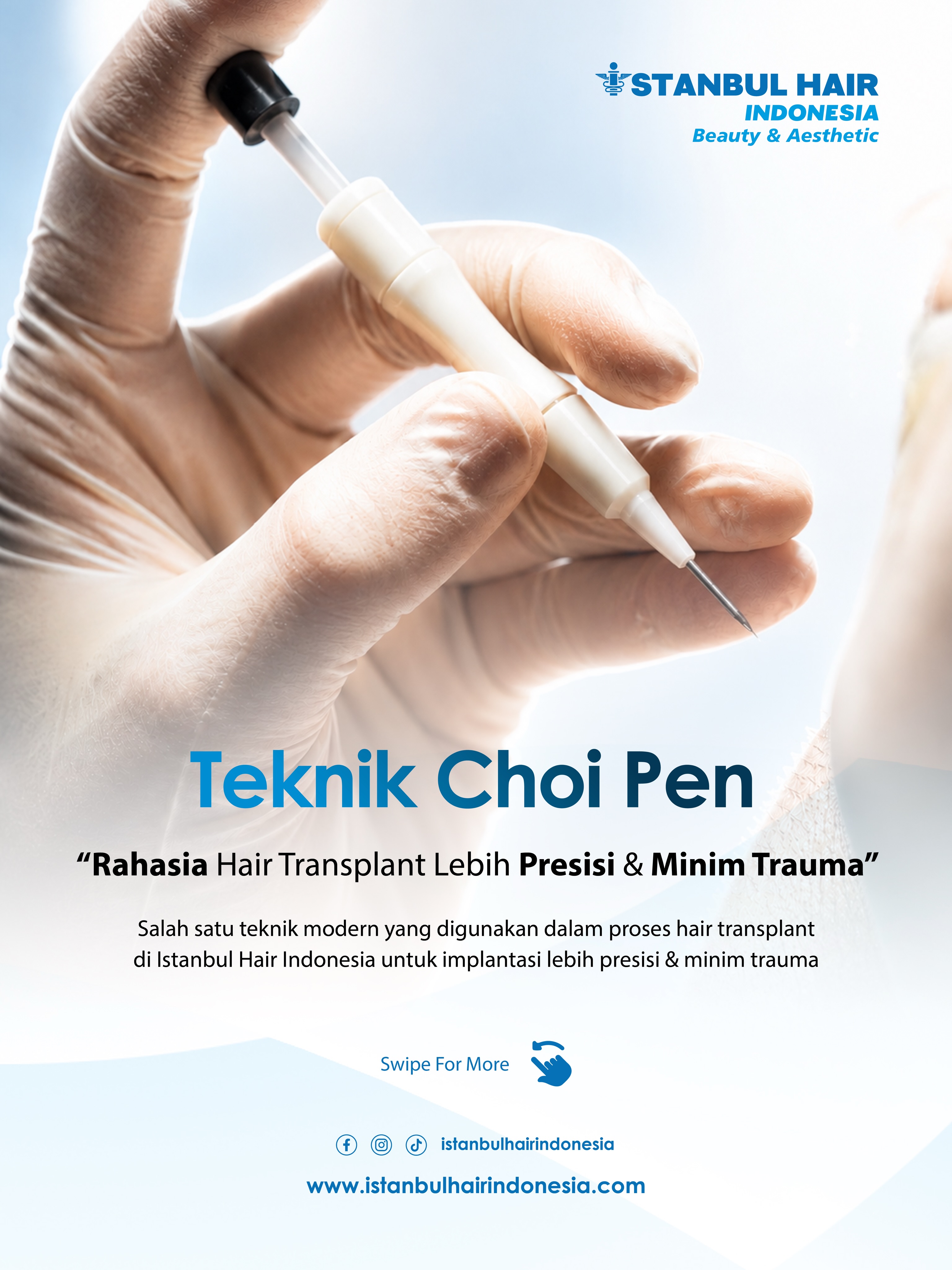 Banyak yang mengira teknik Choi Pen hanya ada di satu tempat tertentu 👀
Padahal, teknik implant menggunakan implanter pen seperti ini juga tersedia di Istanbul Hair Indonesia ✨
Choi Pen merupakan teknik modern dalam hair transplant yang membantu proses penanaman graft lebih presisi, dengan arah tumbuh rambut yang lebih natural & minim trauma pada kulit kepala.
Bukan hanya untuk hairline depan, tapi juga dapat digunakan pada area rambut yang mulai menipis atau jarang 👌
Karena hasil hair transplant bukan hanya soal jumlah graft…
tetapi juga teknik penanamannya 🤍
#IstanbulHairIndonesia #HairTransplantIndonesia #ChoiPen #TanamRambut #HairRestoration