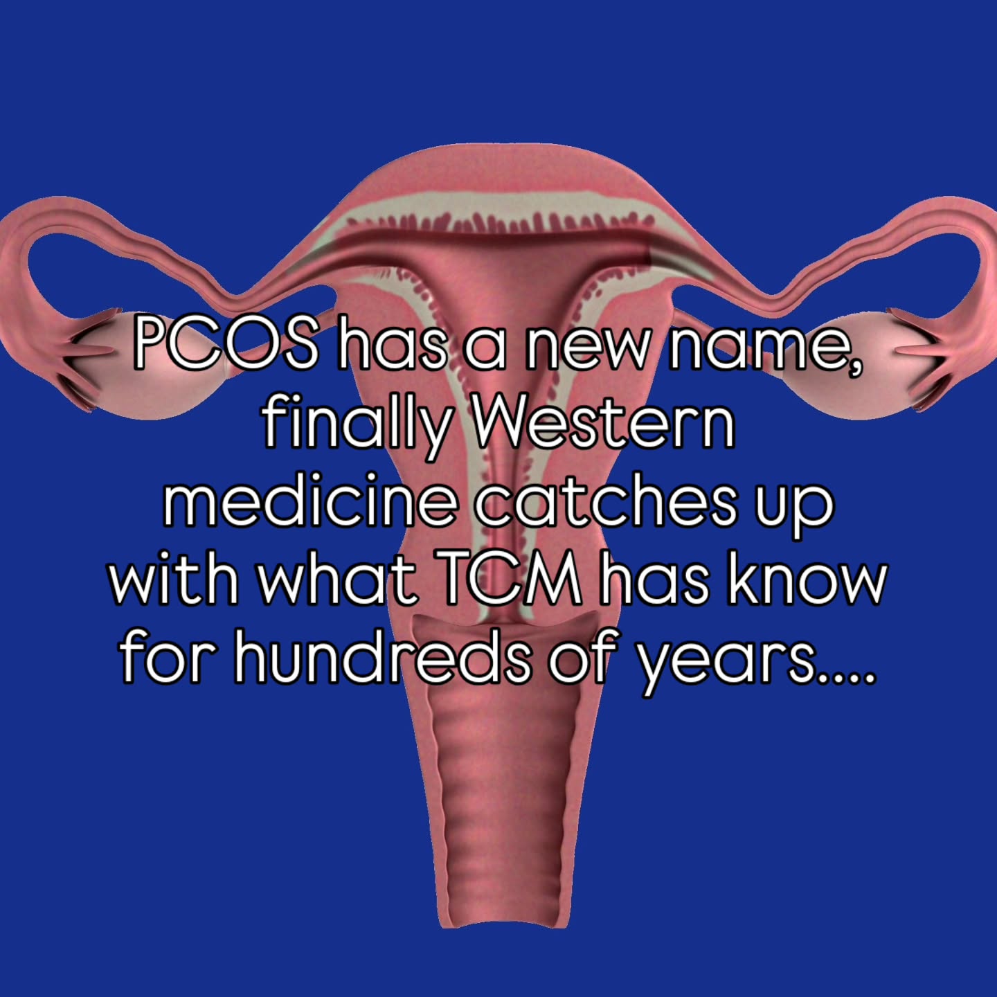 For years, PCOS has been treated as if the ovaries themselves were the problem, but the new proposed name, Polyendocrine Metabolic Ovarian Syndrome, reflects something many holistic practitioners have recognised for a long time: the ovaries are often the signal, not the root cause.
In Traditional Chinese Medicine, symptoms connected to PCOS have always been viewed through a wider lens. The body is seen as an interconnected system, where metabolism, digestion, stress, inflammation, blood sugar regulation and hormonal balance all influence reproductive health.
The ovaries are communicating that something deeper in the body is out of balance. They are not “failing” they are responding to underlying issues.
This shift in understanding matters, because when we stop treating the ovaries as the isolated problem, we can begin supporting the whole person instead of chasing symptoms alone. If western medicine now treats the metabolic issue, the digestion the inflammation and more, the ovaries will respond in turn. Treat the original cause, not the symptoms . Hopefully this will result in much more targeted and efficient treatment for patients. If you have PCOS time to start asking for better treatment! #pcos #takecontrolofyourwellbeing
#wellnessthatworks #acupuncturetamworth
#tcm