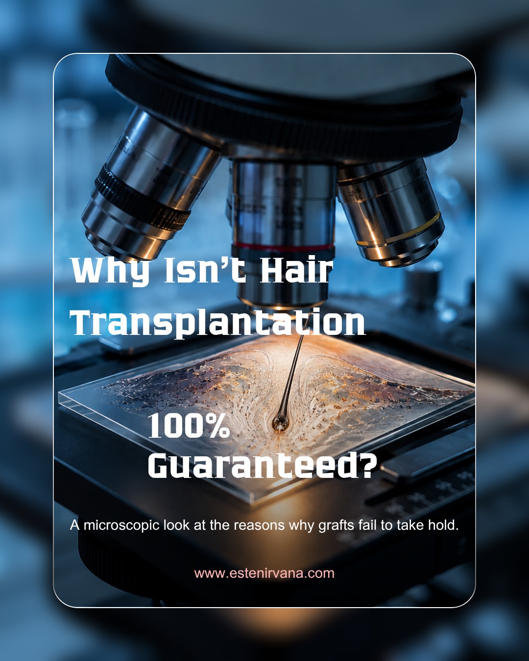 Although many clinics promise 100% success, hair transplantation is a complex biological process. Understanding why some grafts may not “take” helps you manage the process more consciously. Smoking, blood circulation, and most importantly surgical precision are the keys to this outcome. As Estenirvana, we support your dreams with realistic medical protocols and protect every single hair follicle with the utmost care. Transparency is our priority, and your success is our pride. #hairtransplant #graft #hairrestoration #haircare #hairtransplantturkey #scientificperspective