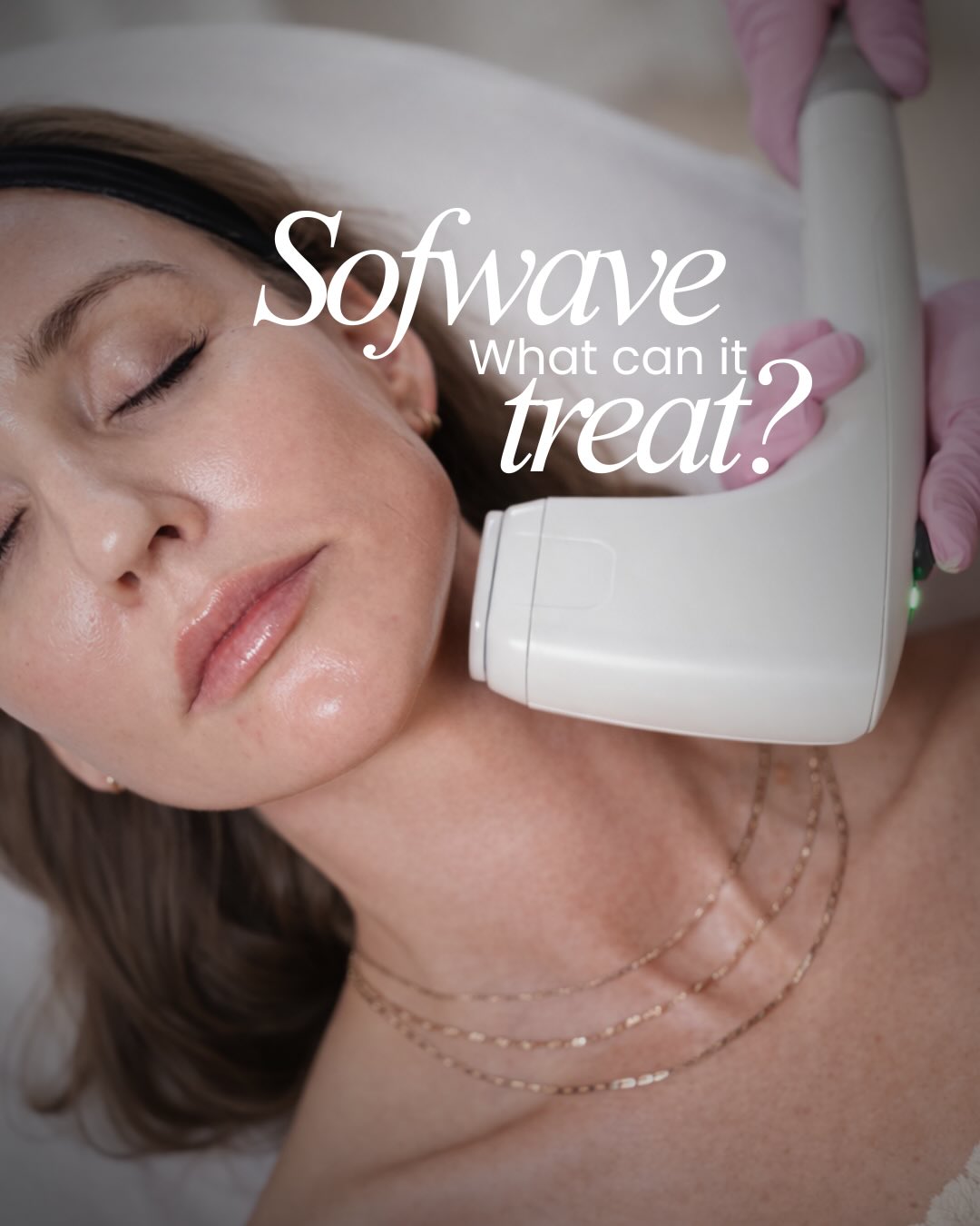 If your skin feels like it’s slowly falling… read this.
You know that moment when your skin just starts to feel… different?
A little heavier. Less snatched. More tired.
Like your face is slowly losing its support system.
That’s skin laxity.
And no cream, facial, or “miracle” serum can fully treat what’s happening deeper in the skin.
That’s where Sofwave comes in.
Sofwave uses advanced ultrasound technology to stimulate collagen at the exact depth where skin support starts to weaken — helping lift, firm, and tighten over time.
Think:
✨ jawline definition
✨ lifted brows
✨ tighter neck skin
✨ smoother texture
✨ softer lines
✨ prevention before things fully “drop”
No surgery.
No needles.
No downtime.
Just collagen stimulation that works WITH your skin…not against it.