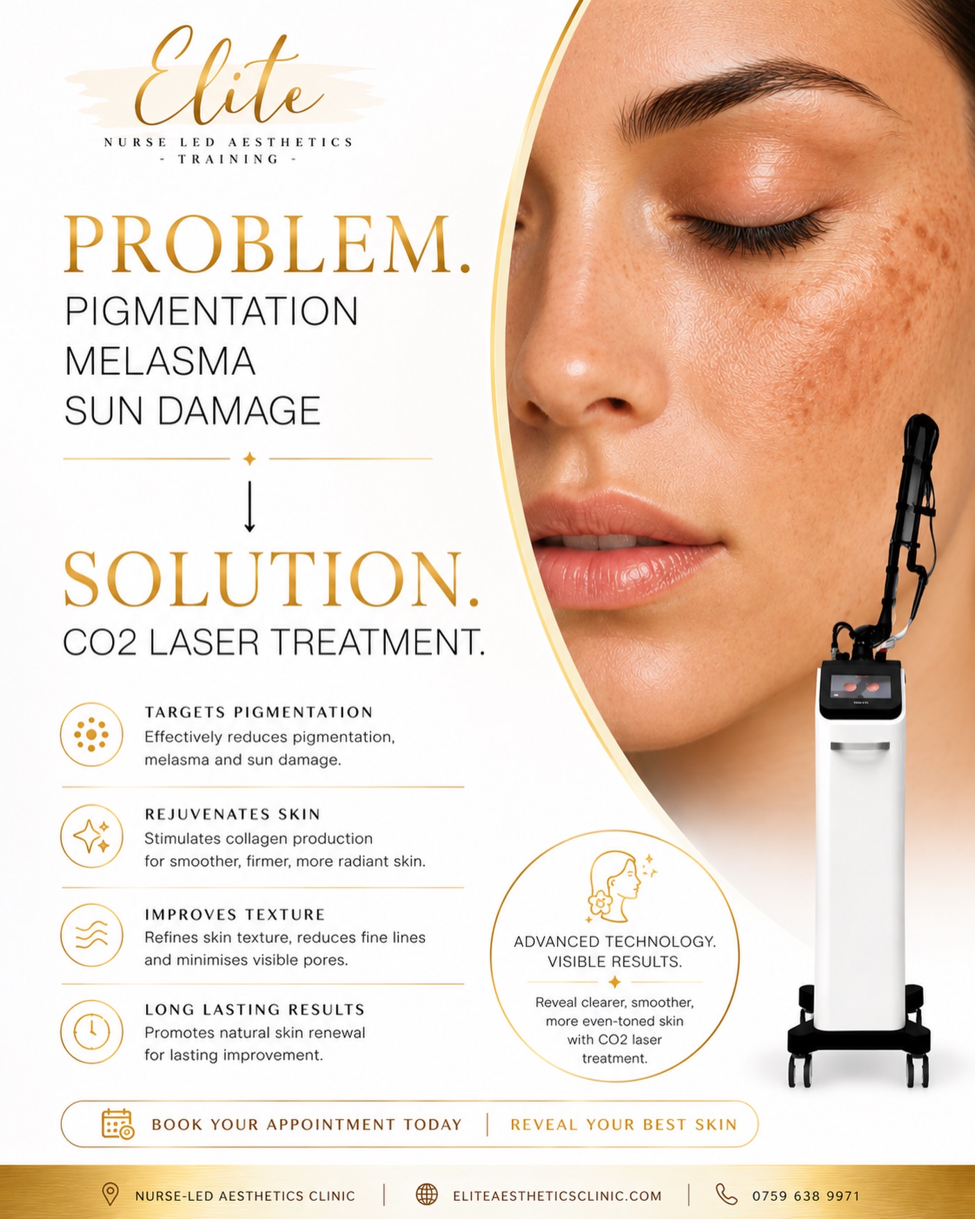 STRUGGLING WITH PIGMENTATION, MELASMA OR SUN DAMAGE? ✨
Your skin concerns don’t have to define your confidence 🤍
CO2 Laser Treatment is designed to resurface, rejuvenate and visibly improve skin texture and tone for smoother, clearer-looking skin.
This advanced treatment helps target:
✨ Pigmentation
✨ Melasma
✨ Sun damage
✨ Uneven texture
✨ Fine lines & pores
Benefits of CO2 Laser:
🤍 Stimulates collagen production
🤍 Improves skin texture & clarity
🤍 Encourages skin renewal
🤍 Long-lasting rejuvenation
🤍 Brighter, healthier-looking skin
Reveal your best skin yet ✨
📍 Elite Nurse Led Aesthetics
💌 DM TO BOOK your consultation today.
#CO2Laser #SkinRejuvenation #EliteAesthetics #PigmentationTreatment #MelasmaTreatment