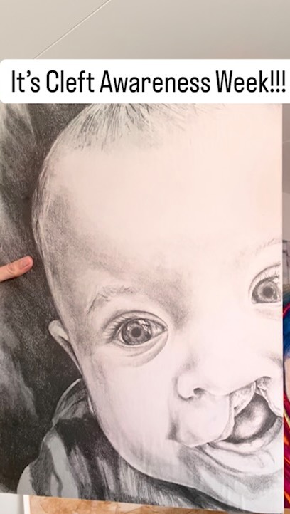 Happy Cleft Awareness Week ❤️
Always choose curiosity and compassion over EVERYTHING else when living your life ❤️
#cleft #cleftfamily #cleftjourney