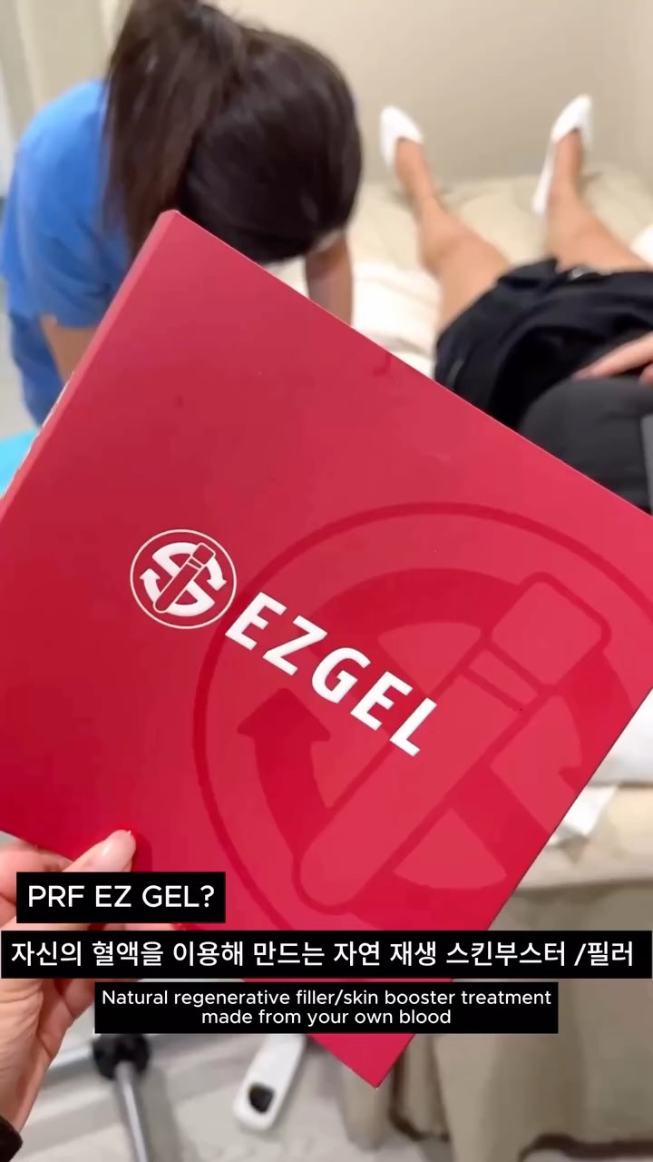 β¨ EZ Gel Reel Caption
Refined, not overdone β¨
EZ Gel delivers natural volume + skin regeneration in one treatment.
Derived from your own blood,
it improves under-eye hollowness, fine lines, and overall skin quality
while maintaining a soft, natural look.
π smoother
π healthier
π naturally refreshed
real skin, just elevated β¨
π 3000 W Olympic BlvdΒ #305, Los Angeles
π 213-814-8410
#ezgel #skinregeneration #naturalfiller #prf #prptreatment #undereyecorrection #undereyerejuvenation #antiaging #skinquality #glowingskin #glassskin #subtlebeauty #aestheticclinic #medspa #medicalspa #losangelesmedspa #kbeauty #skincareinjection #collagenboost #naturalresults